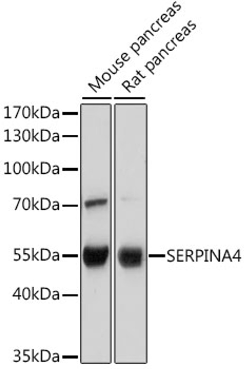 Western blot analysis of extracts of various cell lines, using SERPINA4 antibody (22-862) at 1:500 dilution.<br/>Secondary antibody: HRP Goat Anti-Rabbit IgG (H+L) at 1:10000 dilution.<br/>Lysates/proteins: 25ug per lane.<br/>Blocking buffer: 3% nonfat dry milk in TBST.<br/>Detection: ECL Basic Kit.<br/>Exposure time: 1s.