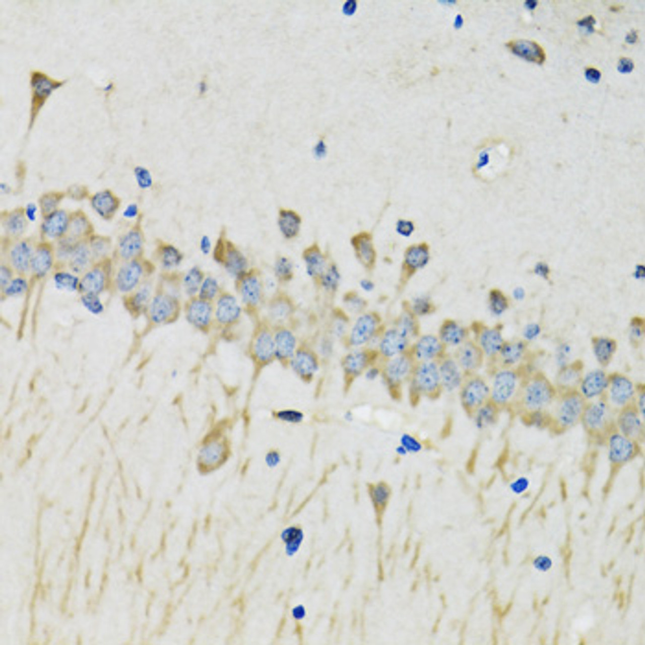Immunohistochemistry of paraffin-embedded mouse brain using SERPINA4 antibody (22-862) at dilution of 1:100 (40x lens) .