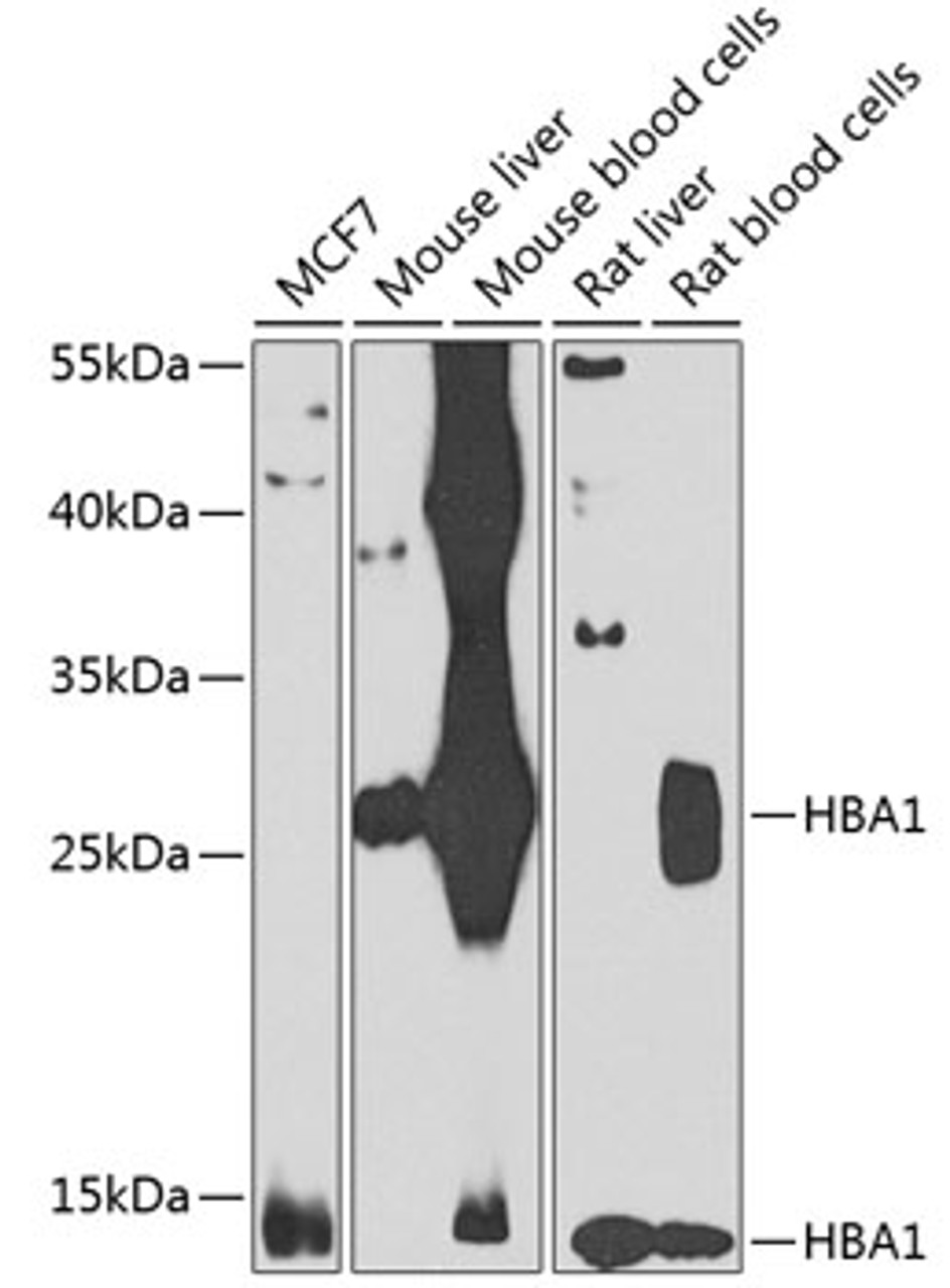 Western blot analysis of extracts of various cell lines, using HBA1 antibody (22-863) at 1:1000 dilution._Secondary antibody: HRP Goat Anti-Rabbit IgG (H+L) at 1:10000 dilution._Lysates/proteins: 25ug per lane._Blocking buffer: 3% nonfat dry milk in TBST._Detection: ECL Enhanced Kit._Exposure time: 30s.