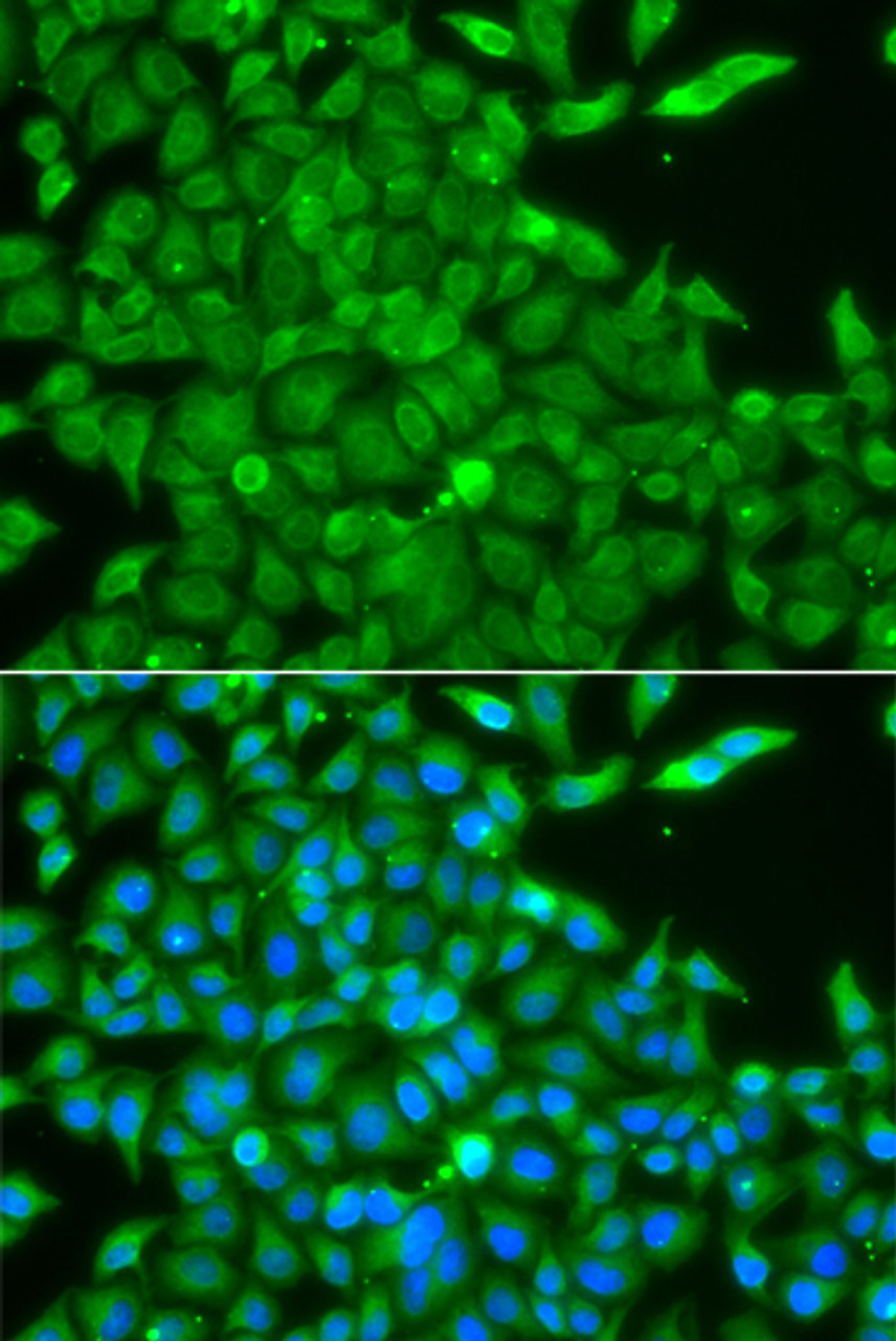 Immunofluorescence analysis of A549 cells using CSNK1G2 antibody (22-865) . Blue: DAPI for nuclear staining.