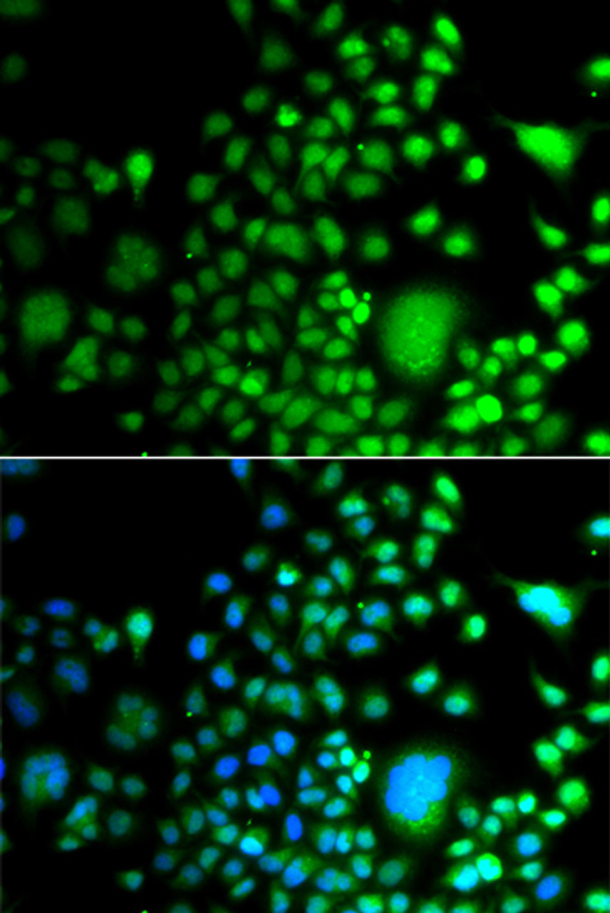Immunofluorescence analysis of A549 cells using PAX6 antibody (22-869) . Blue: DAPI for nuclear staining.
