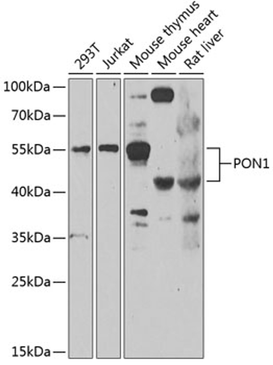 Western blot analysis of extracts of various cell lines, using PON1 antibody (22-873) at 1:1000 dilution.<br/>Secondary antibody: HRP Goat Anti-Rabbit IgG (H+L) at 1:10000 dilution.<br/>Lysates/proteins: 25ug per lane.<br/>Blocking buffer: 3% nonfat dry milk in TBST.<br/>Detection: ECL Enhanced Kit.<br/>Exposure time: 90s.