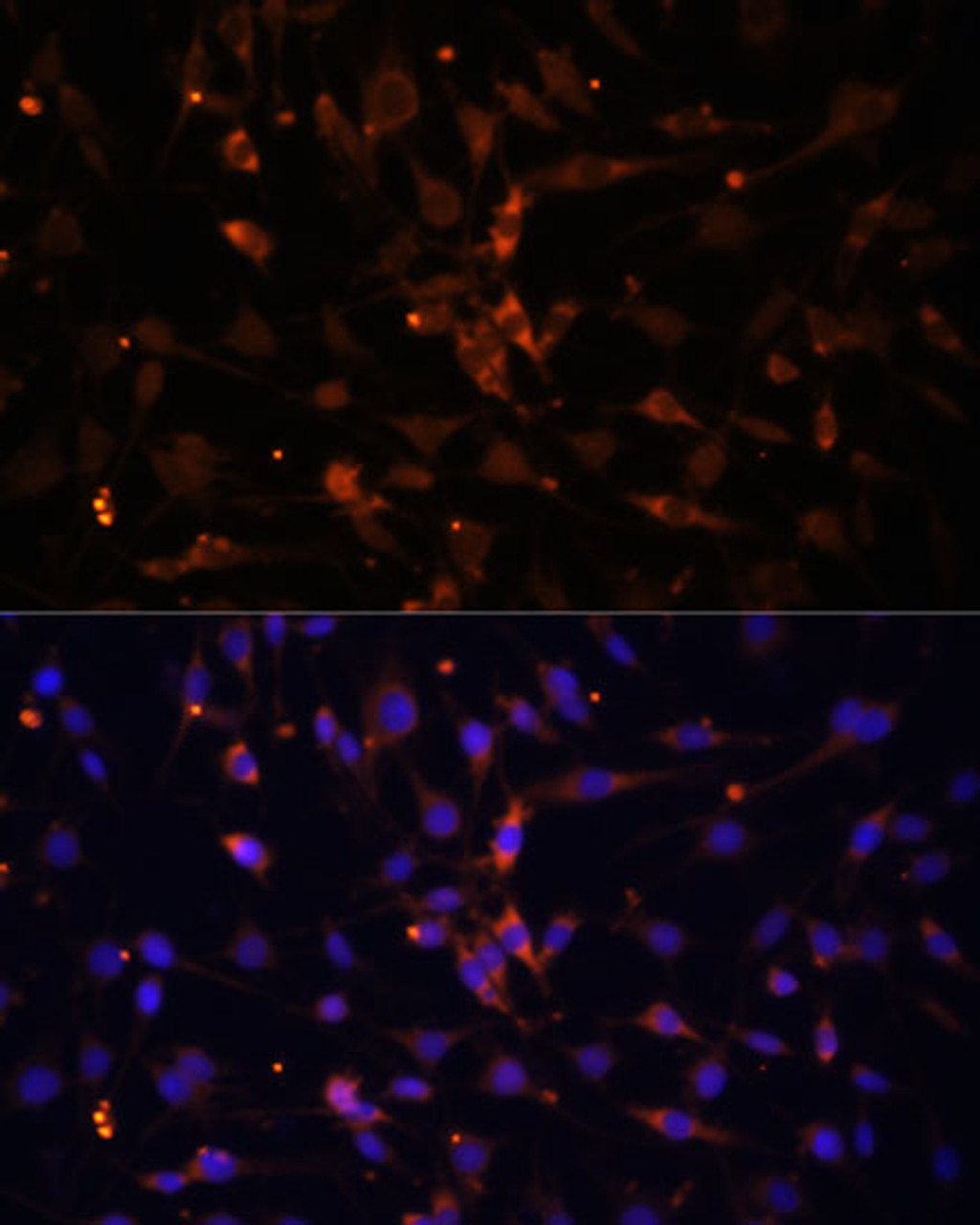 Immunofluorescence analysis of C6 cells using PRKAA2 Polyclonal Antibody (22-874) at dilution of 1:100 (40x lens) . Blue: DAPI for nuclear staining.