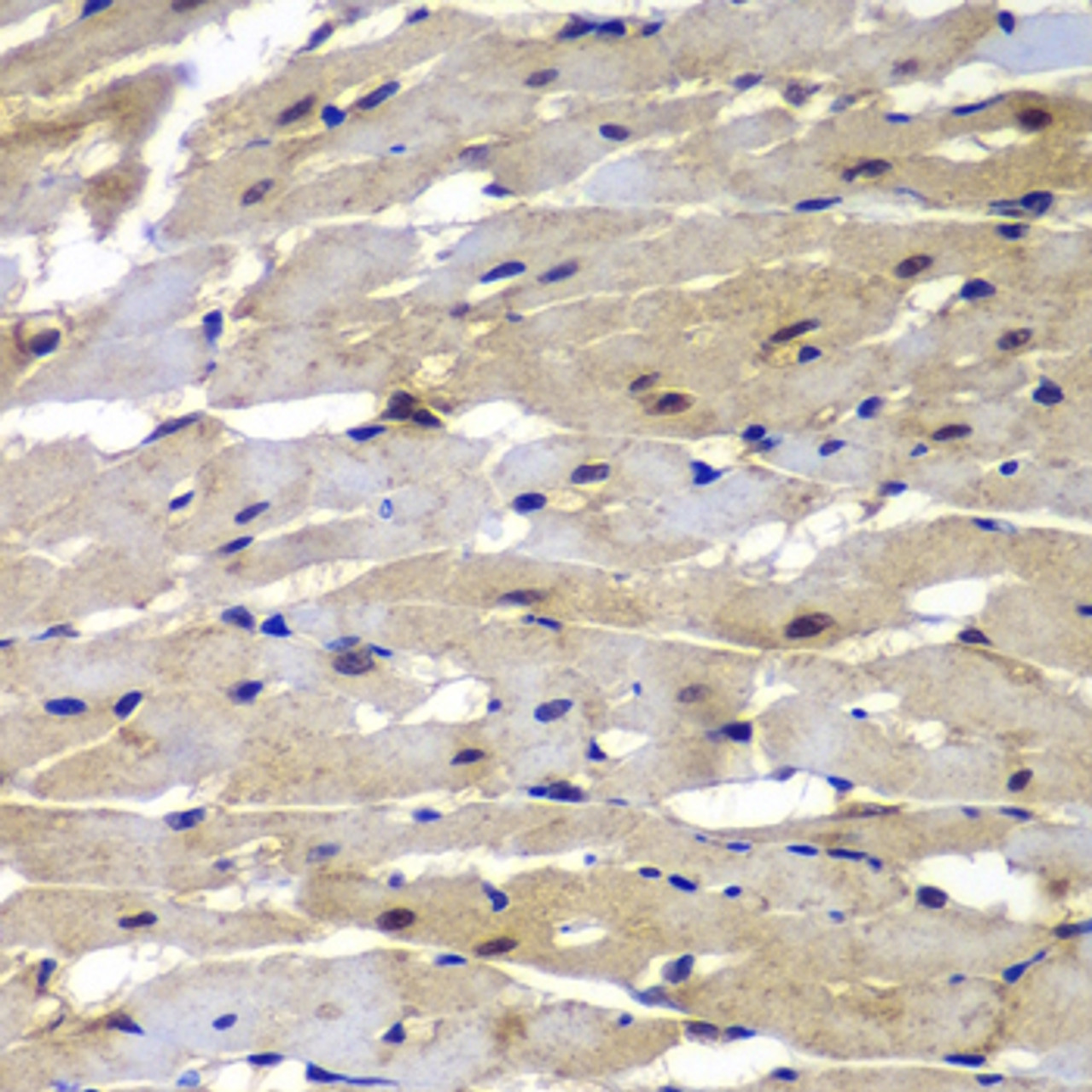 Immunohistochemistry of paraffin-embedded rat heart using PSMB8 antibody (22-875) at dilution of 1:100 (40x lens) .