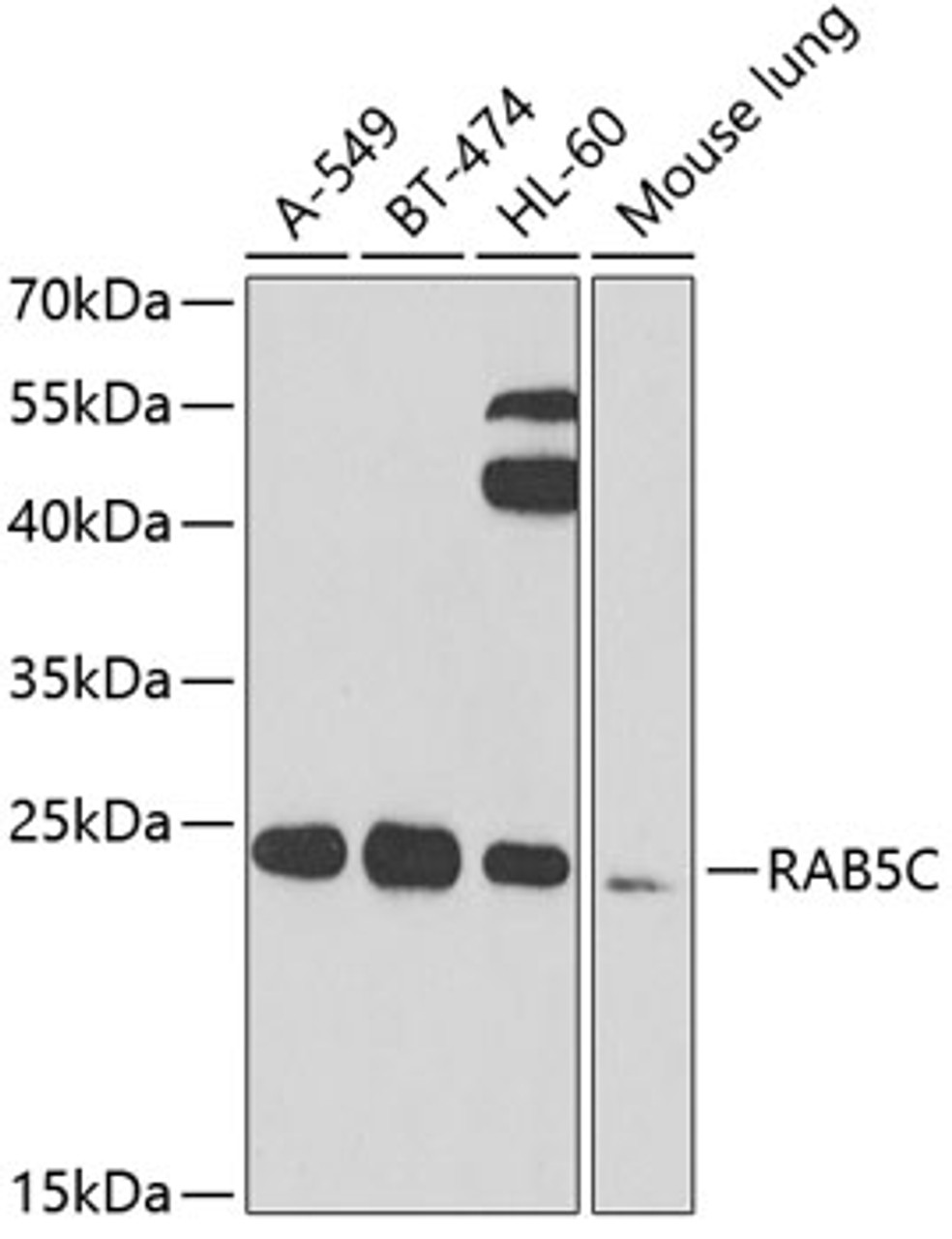 Western blot analysis of extracts of various cell lines, using RAB5C antibody (22-877) at 1:1000 dilution._Secondary antibody: HRP Goat Anti-Rabbit IgG (H+L) at 1:10000 dilution._Lysates/proteins: 25ug per lane._Blocking buffer: 3% nonfat dry milk in TBST._Detection: ECL Enhanced Kit._Exposure time: 90s.