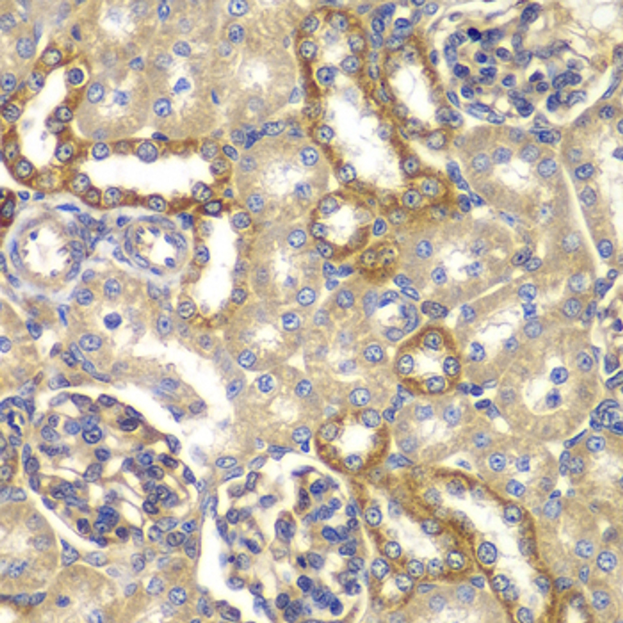 Immunohistochemistry of paraffin-embedded rat kidney using RAB5C antibody (22-877) at dilution of 1:100 (40x lens) .