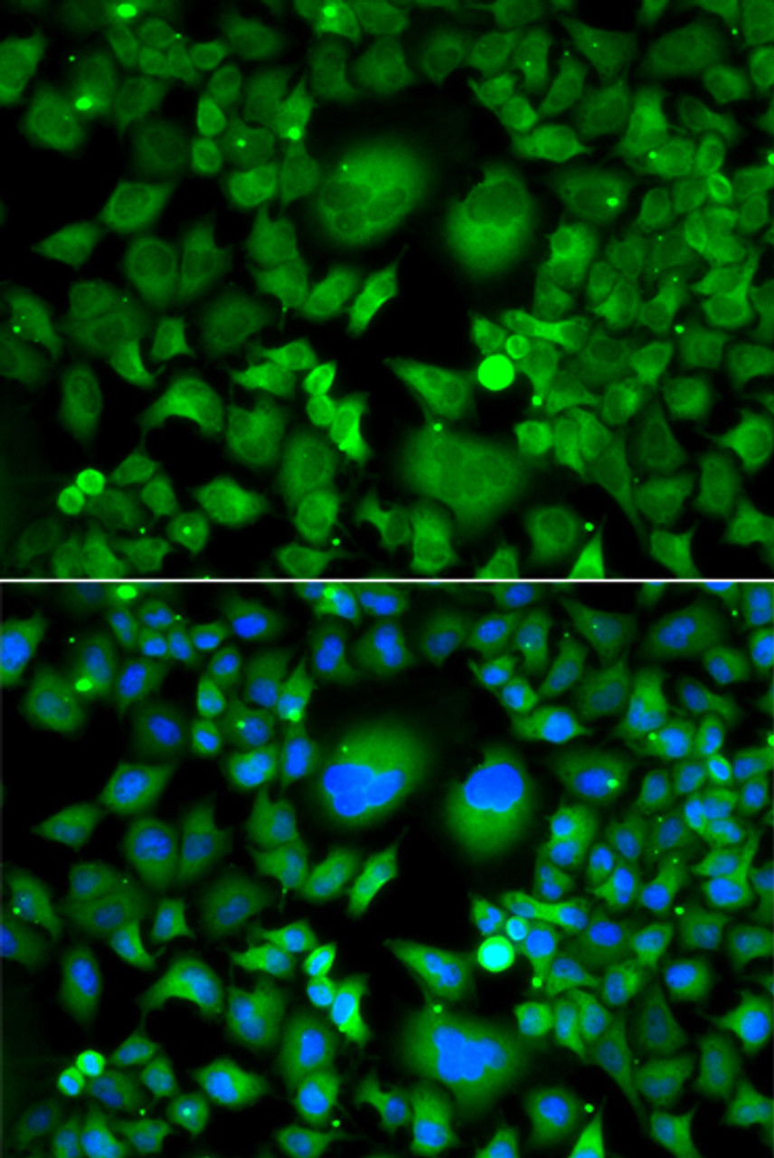 Immunofluorescence analysis of A549 cells using UBE2H antibody (22-879) . Blue: DAPI for nuclear staining.