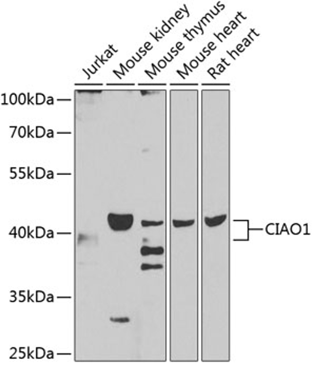 Western blot analysis of extracts of various cell lines, using CIAO1 antibody (22-888) at 1:1000 dilution.<br/>Secondary antibody: HRP Goat Anti-Rabbit IgG (H+L) at 1:10000 dilution.<br/>Lysates/proteins: 25ug per lane.<br/>Blocking buffer: 3% nonfat dry milk in TBST.<br/>Detection: ECL Enhanced Kit.<br/>Exposure time: 90s.