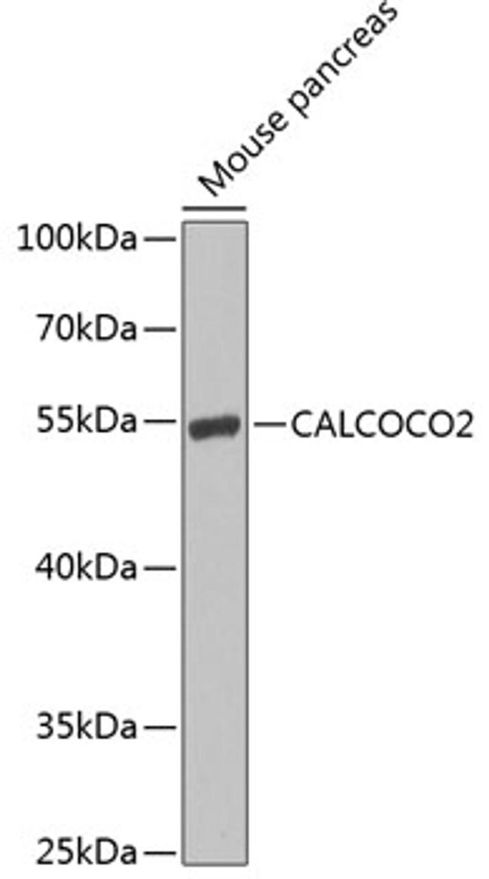 Western blot analysis of extracts of mouse pancreas, using CALCOCO2 antibody (22-889) at 1:1000 dilution._Secondary antibody: HRP Goat Anti-Rabbit IgG (H+L) at 1:10000 dilution._Lysates/proteins: 25ug per lane._Blocking buffer: 3% nonfat dry milk in TBST._Detection: ECL Enhanced Kit._Exposure time: 90s.