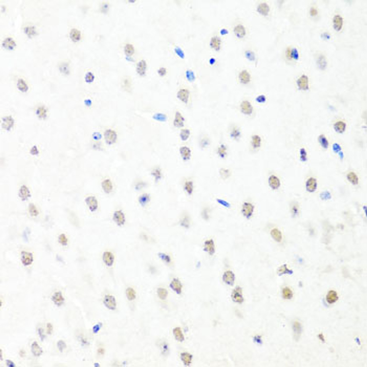 Immunohistochemistry of paraffin-embedded mouse brain using CHRAC1 antibody (22-896) at dilution of 1:100 (40x lens) .