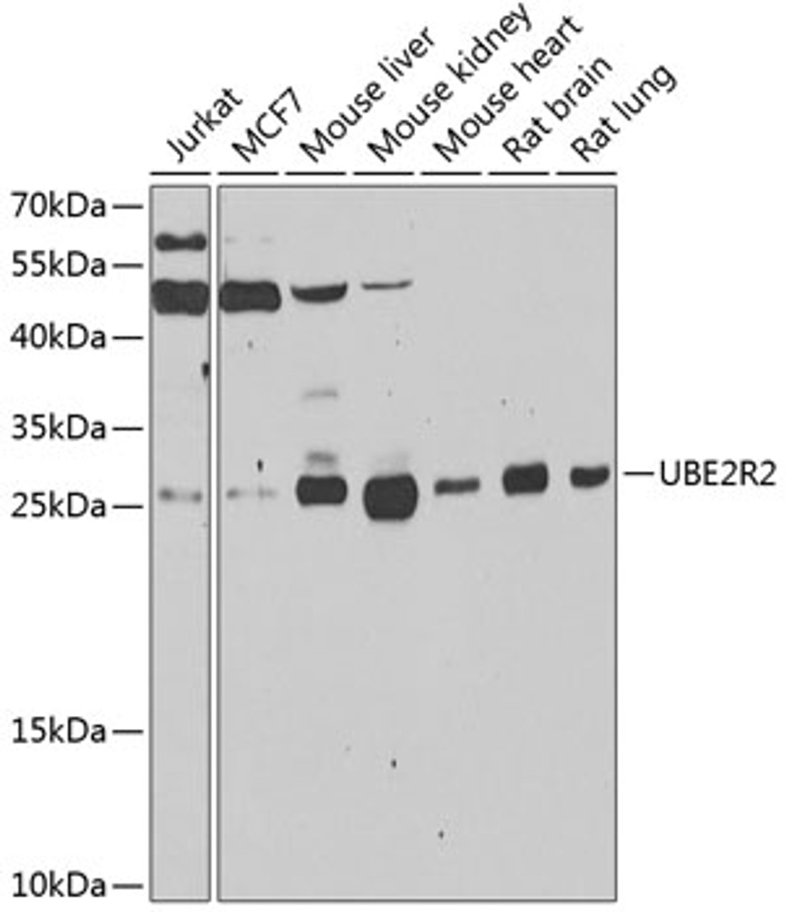 Western blot analysis of extracts of various cell lines, using UBE2R2 antibody (22-897) at 1:1000 dilution.<br/>Secondary antibody: HRP Goat Anti-Rabbit IgG (H+L) at 1:10000 dilution.<br/>Lysates/proteins: 25ug per lane.<br/>Blocking buffer: 3% nonfat dry milk in TBST.<br/>Detection: ECL Enhanced Kit.<br/>Exposure time: 30s.