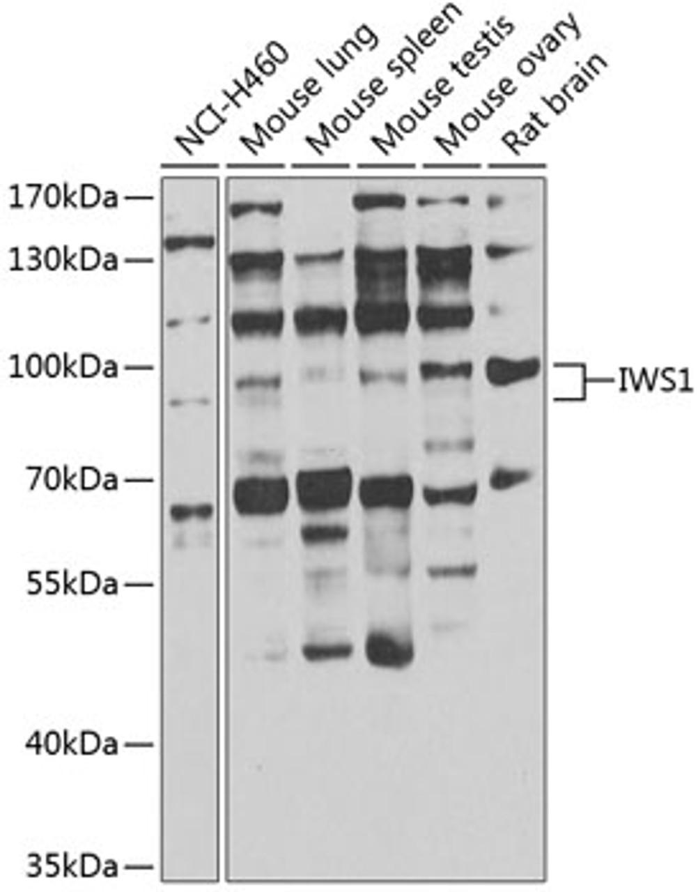 Western blot analysis of extracts of various cell lines, using IWS1 antibody (22-899) at 1:1000 dilution.<br/>Secondary antibody: HRP Goat Anti-Rabbit IgG (H+L) at 1:10000 dilution.<br/>Lysates/proteins: 25ug per lane.<br/>Blocking buffer: 3% nonfat dry milk in TBST.<br/>Detection: ECL Enhanced Kit.<br/>Exposure time: 5s.