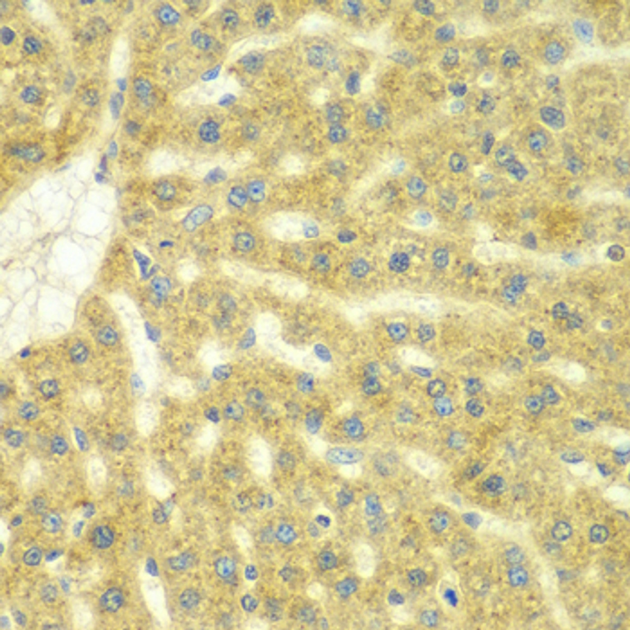 Immunohistochemistry of paraffin-embedded rat liver using ADCK3 antibody (22-901) at dilution of 1:100 (40x lens) .