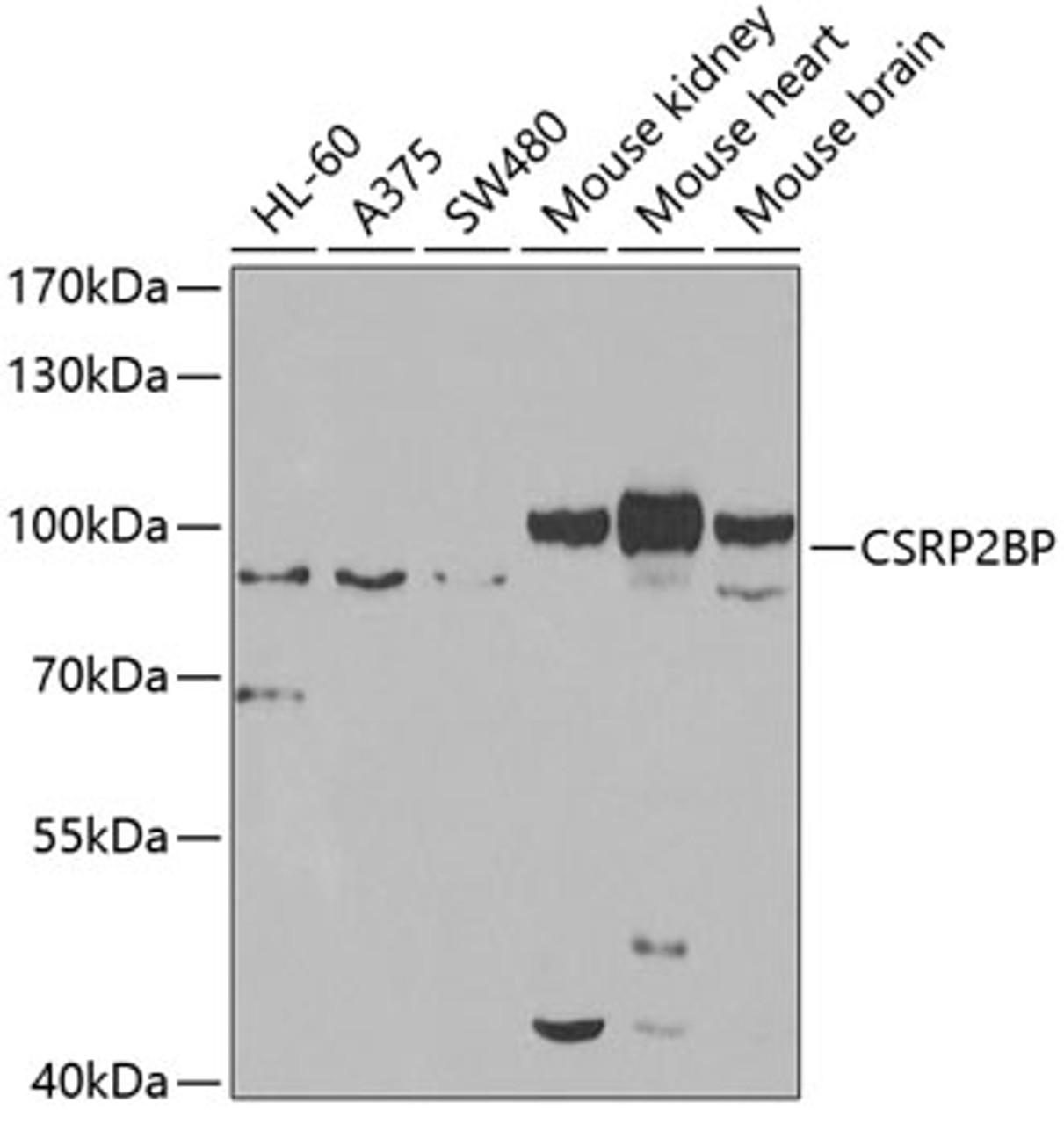Western blot analysis of extracts of various cell lines, using CSRP2BP antibody (22-903) at 1:1000 dilution._Secondary antibody: HRP Goat Anti-Rabbit IgG (H+L) at 1:10000 dilution._Lysates/proteins: 25ug per lane._Blocking buffer: 3% nonfat dry milk in TBST._Detection: ECL Enhanced Kit._Exposure time: 90s.