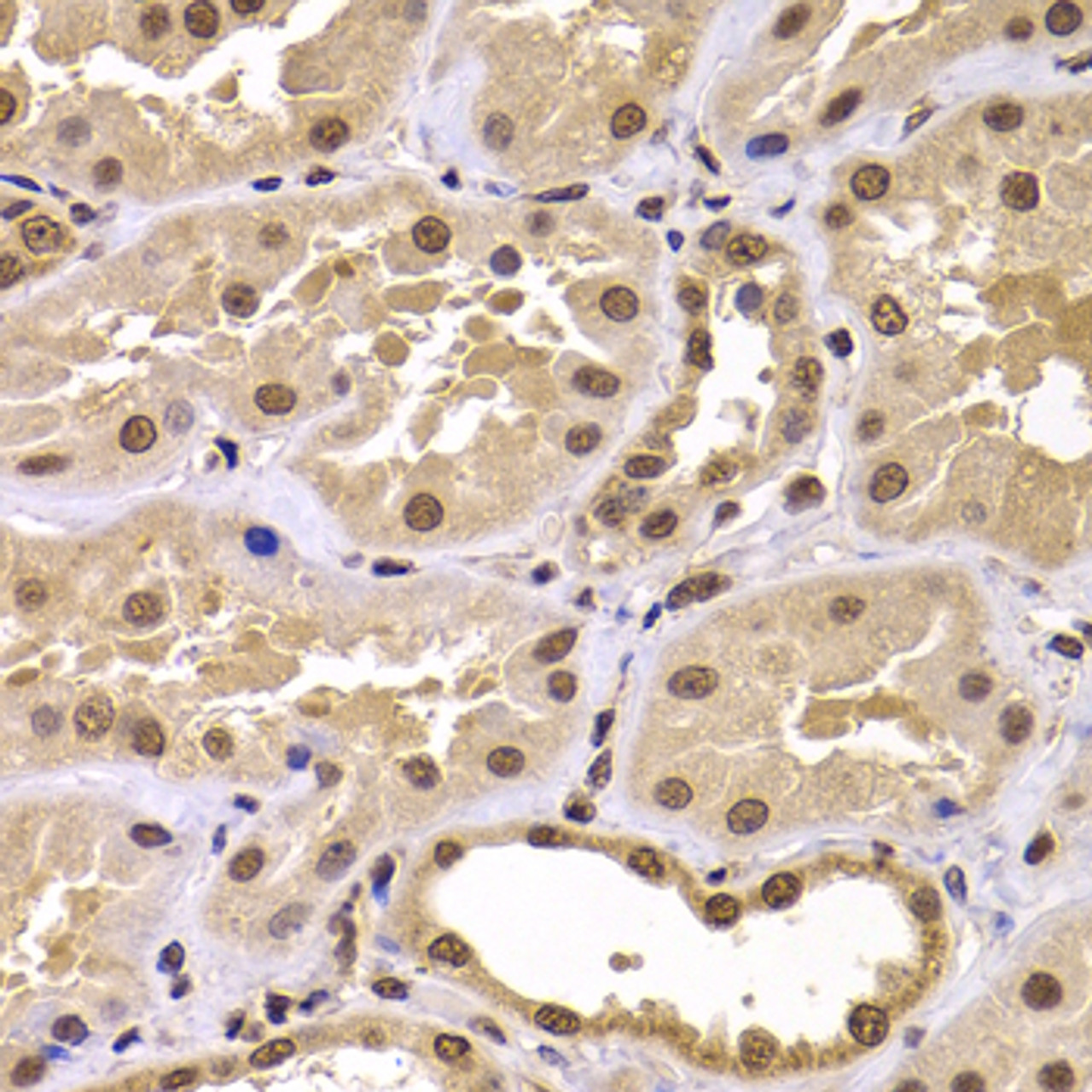 Immunohistochemistry of paraffin-embedded human kidney using CSRP2BP antibody (22-903) at dilution of 1:100 (40x lens) .