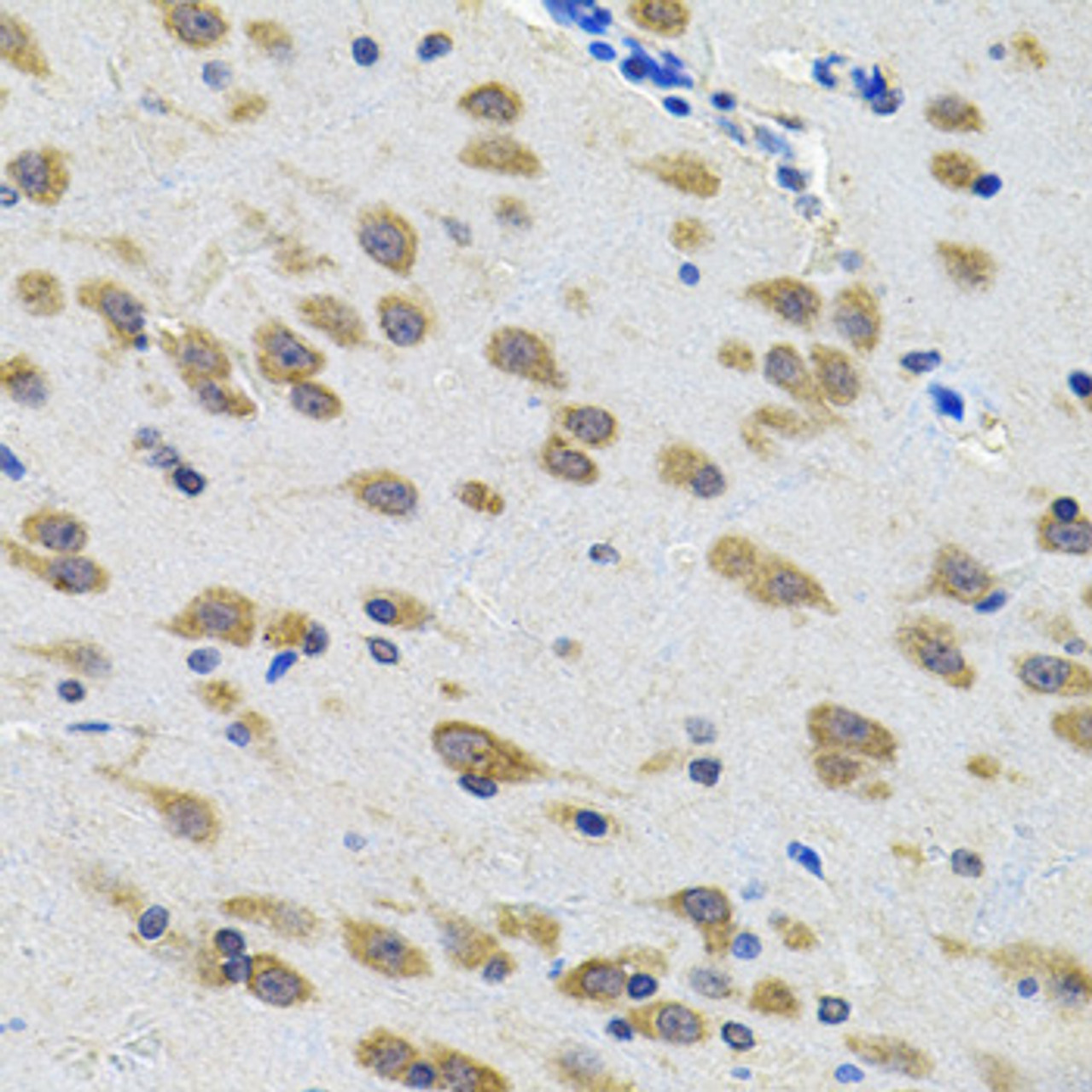 Immunohistochemistry of paraffin-embedded rat brain using LGR6 Antibody (22-904) at dilution of 1:100 (40x lens) .