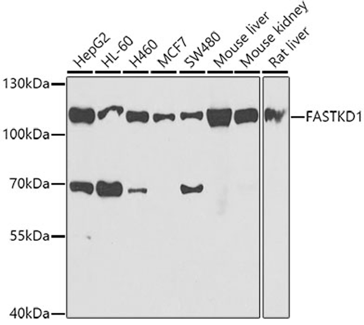 Western blot analysis of extracts of various cell lines, using FASTKD1 antibody (22-905) at 1:1000 dilution.<br/>Secondary antibody: HRP Goat Anti-Rabbit IgG (H+L) at 1:10000 dilution.<br/>Lysates/proteins: 25ug per lane.<br/>Blocking buffer: 3% nonfat dry milk in TBST.<br/>Detection: ECL Basic Kit.<br/>Exposure time: 90s.