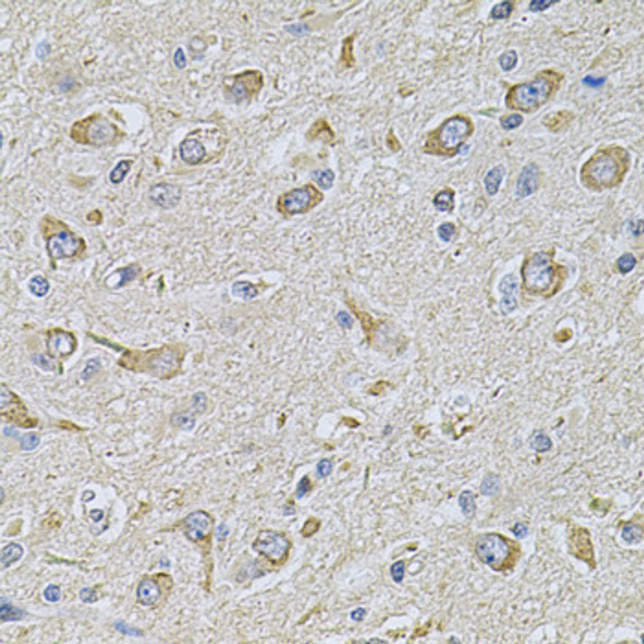 Immunohistochemistry of paraffin-embedded rat brain using FASTKD1 Antibody (22-905) at dilution of 1:100 (40x lens) .