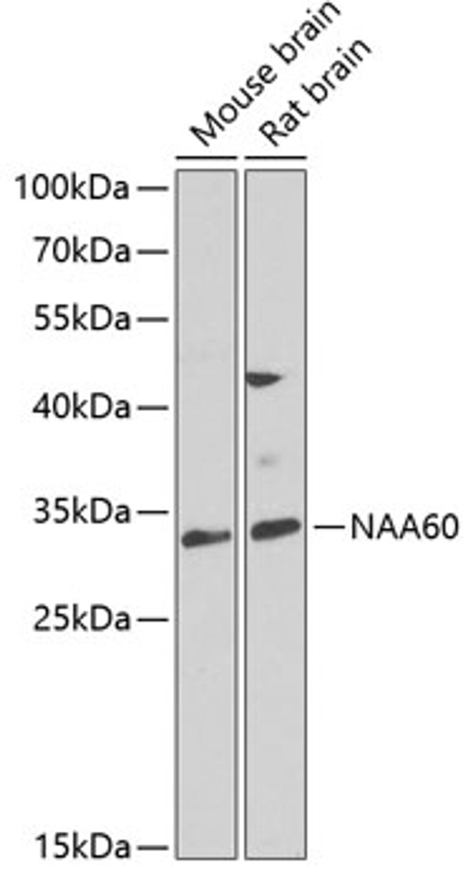 Western blot analysis of extracts of various cell lines, using NAA60 antibody (22-906) at 1:1000 dilution._Secondary antibody: HRP Goat Anti-Rabbit IgG (H+L) at 1:10000 dilution._Lysates/proteins: 25ug per lane._Blocking buffer: 3% nonfat dry milk in TBST._Detection: ECL Enhanced Kit._Exposure time: 90s.
