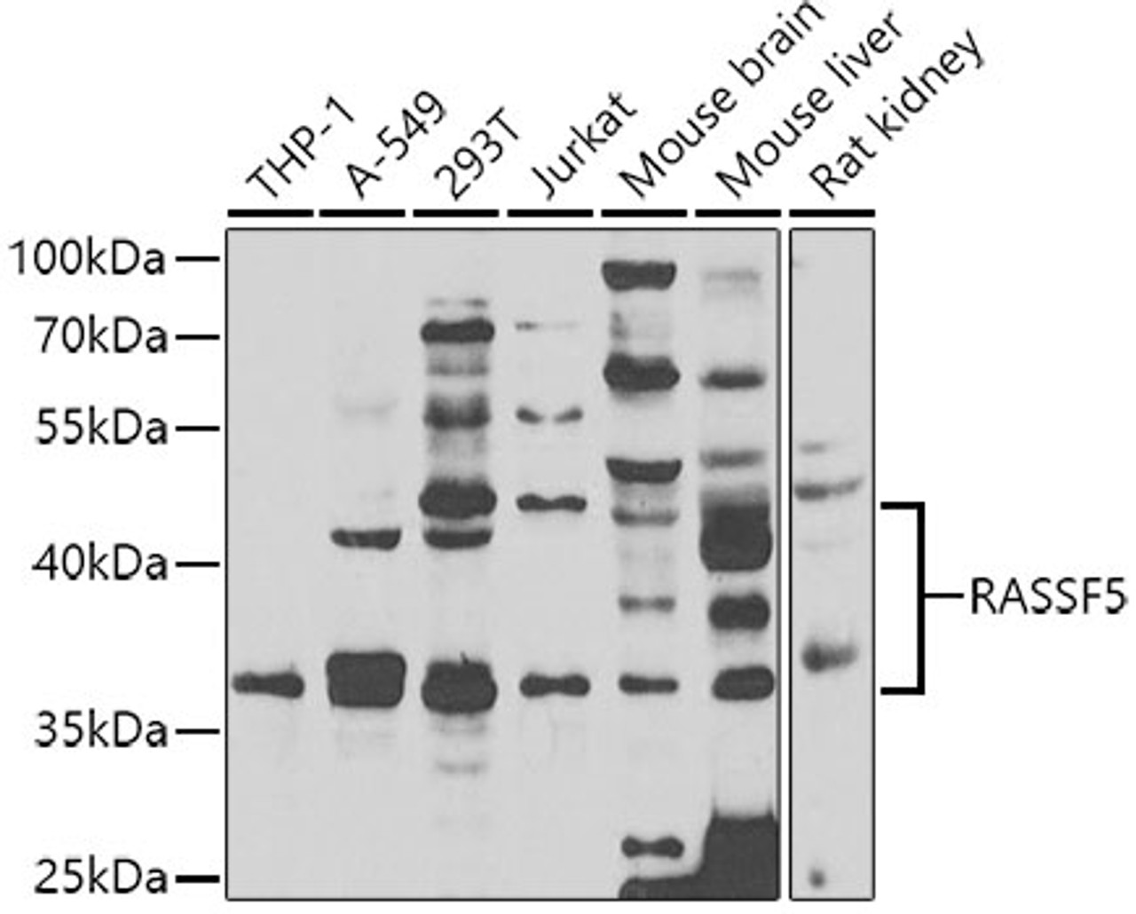 Western blot analysis of extracts of various cell lines, using RASSF5 antibody (22-908) at 1:1000 dilution.<br/>Secondary antibody: HRP Goat Anti-Rabbit IgG (H+L) at 1:10000 dilution.<br/>Lysates/proteins: 25ug per lane.<br/>Blocking buffer: 3% nonfat dry milk in TBST.<br/>Detection: ECL Basic Kit.<br/>Exposure time: 90s.