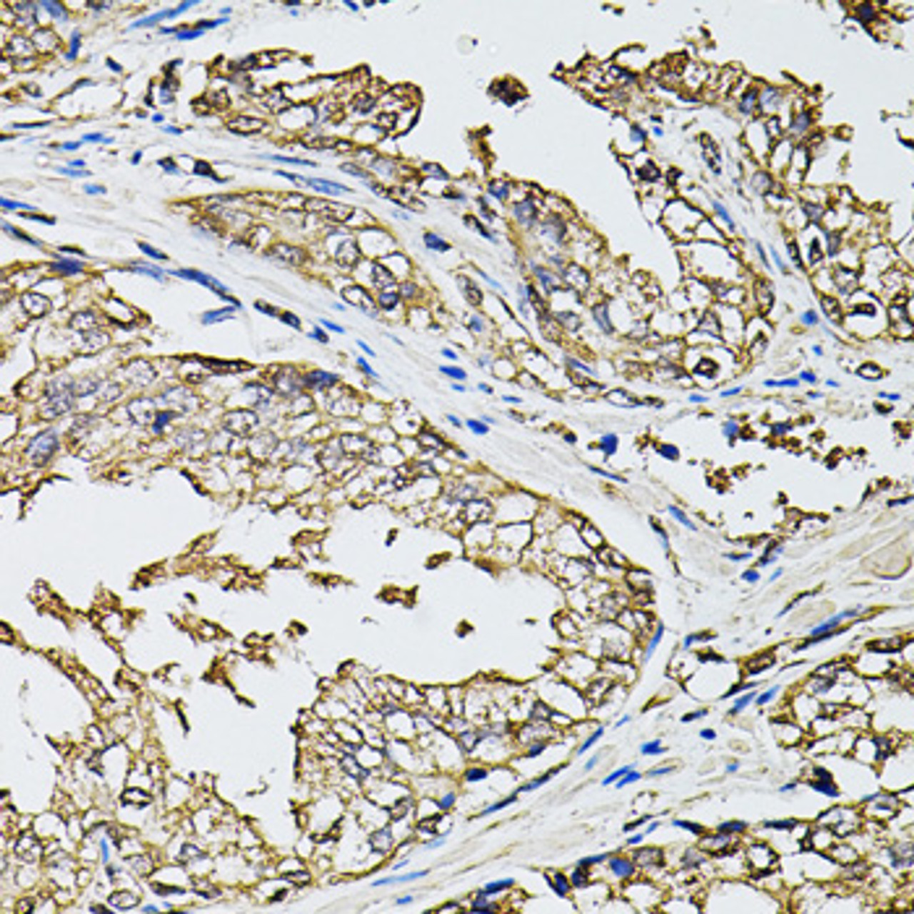 Immunohistochemistry of paraffin-embedded human prostate using RASSF5 antibody (22-908) at dilution of 1:100 (40x lens) .