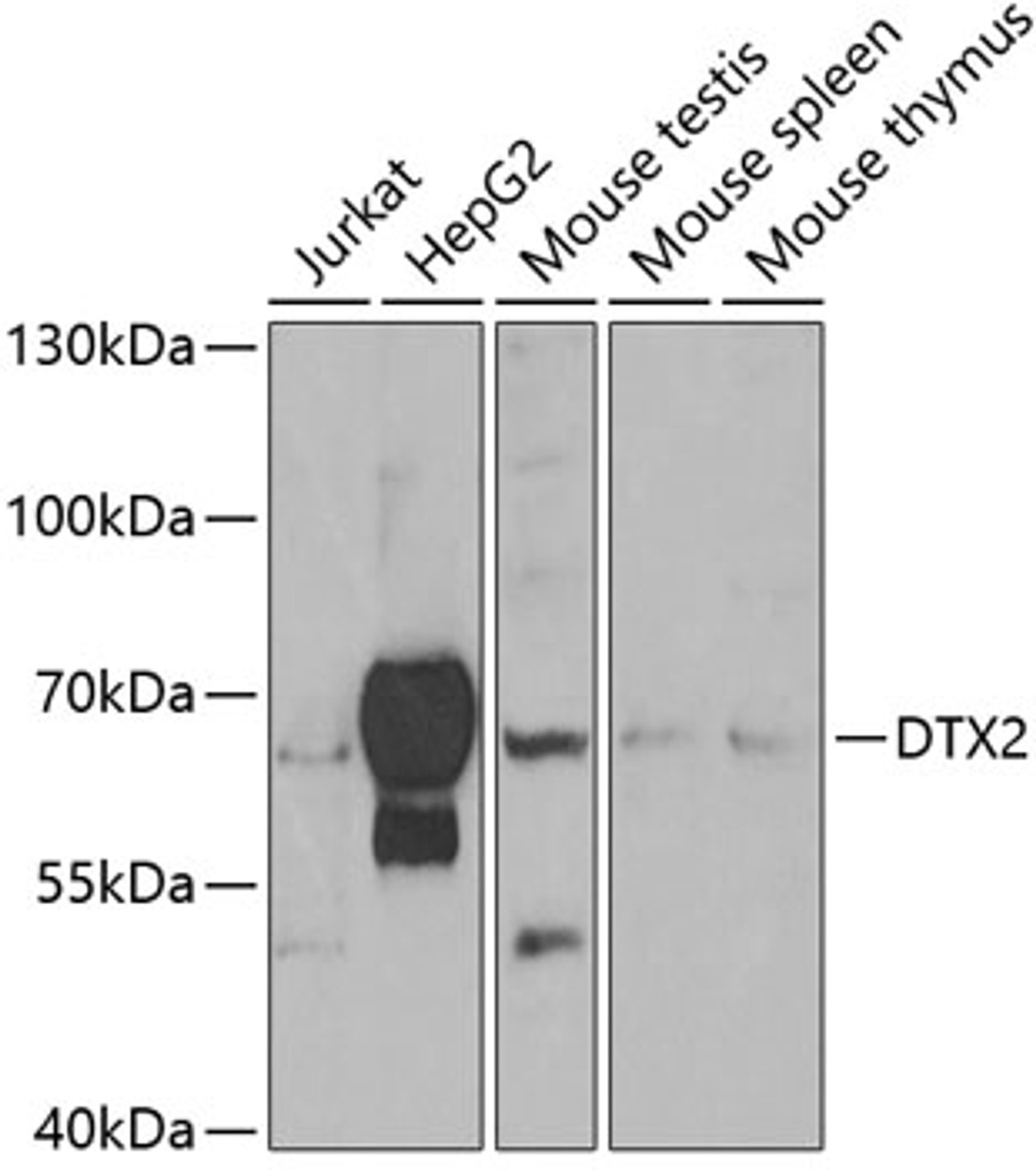Western blot analysis of extracts of various cell lines, using DTX2 antibody (22-913) at 1:1000 dilution._Secondary antibody: HRP Goat Anti-Rabbit IgG (H+L) at 1:10000 dilution._Lysates/proteins: 25ug per lane._Blocking buffer: 3% nonfat dry milk in TBST._Detection: ECL Enhanced Kit._Exposure time: 90s.