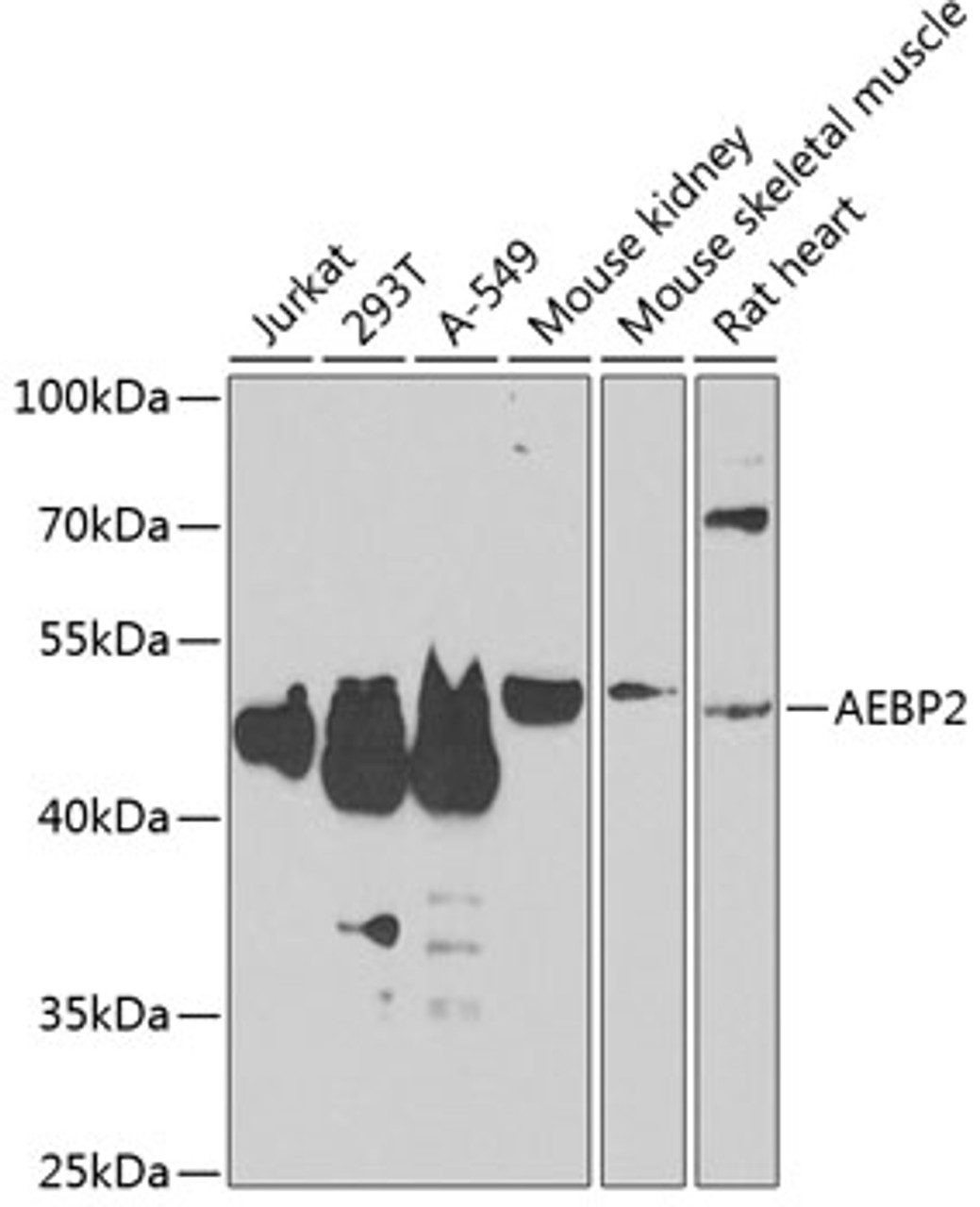 Western blot analysis of extracts of various cell lines, using AEBP2 antibody (22-914) at 1:1000 dilution._Secondary antibody: HRP Goat Anti-Rabbit IgG (H+L) at 1:10000 dilution._Lysates/proteins: 25ug per lane._Blocking buffer: 3% nonfat dry milk in TBST._Detection: ECL Enhanced Kit._Exposure time: 90s.