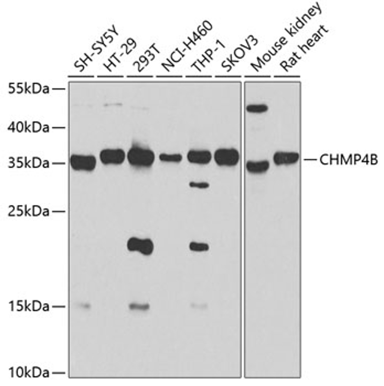 Western blot analysis of extracts of various cell lines, using CHMP4B antibody (22-916) at 1:1000 dilution._Secondary antibody: HRP Goat Anti-Rabbit IgG (H+L) at 1:10000 dilution._Lysates/proteins: 25ug per lane._Blocking buffer: 3% nonfat dry milk in TBST._Detection: ECL Enhanced Kit._Exposure time: 20s.