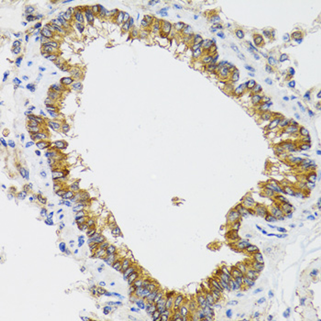 Immunohistochemistry of paraffin-embedded rat lung using CHMP4B antibody (22-916) at dilution of 1:100 (40x lens) .