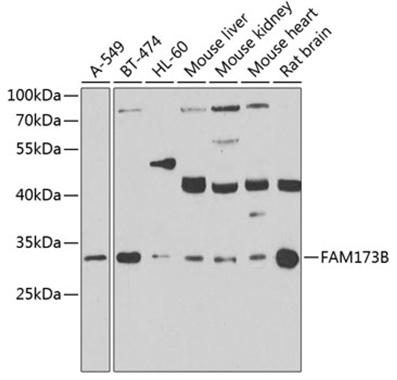 Western blot analysis of extracts of various cell lines, using FAM173B antibody (22-917) at 1:1000 dilution._Secondary antibody: HRP Goat Anti-Rabbit IgG (H+L) at 1:10000 dilution._Lysates/proteins: 25ug per lane._Blocking buffer: 3% nonfat dry milk in TBST._Detection: ECL Enhanced Kit._Exposure time: 90s.
