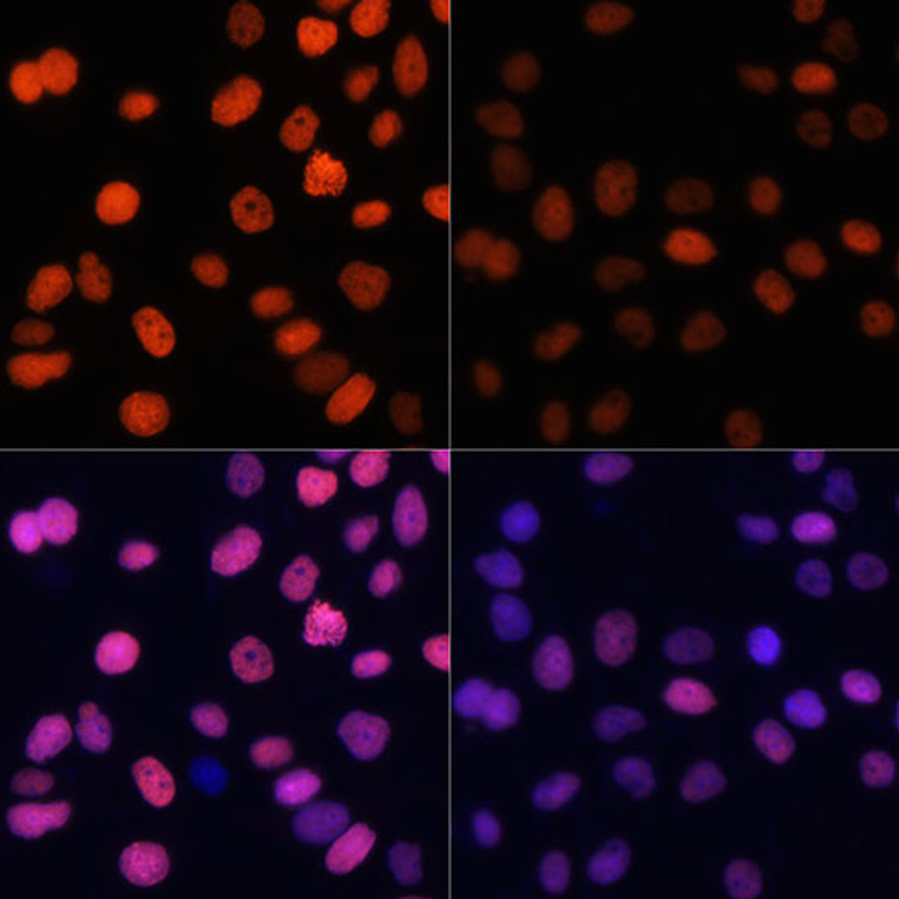 Immunofluorescence analysis of HeLa cells using Acetyl-Histone H4-K91 antibody (22-921) at dilution of 1:100.HeLa cells were treated by TSA (1 uM) at 37℃ for 18 hours. Blue: DAPI for nuclear staining.