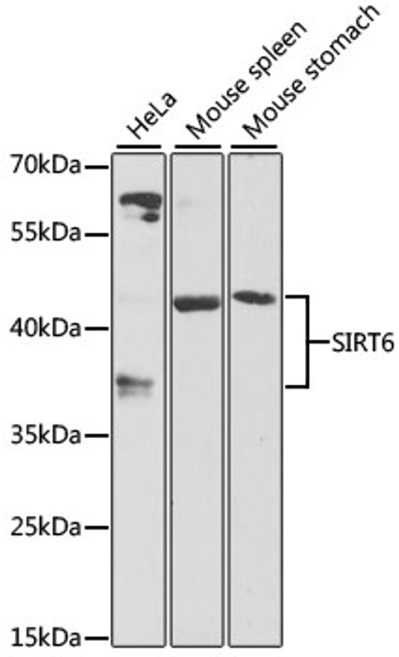 Western blot analysis of extracts of various cell lines, using SIRT6 antibody (22-923) at 1:1000 dilution.<br/>Secondary antibody: HRP Goat Anti-Rabbit IgG (H+L) at 1:10000 dilution.<br/>Lysates/proteins: 25ug per lane.<br/>Blocking buffer: 3% nonfat dry milk in TBST.<br/>Detection: ECL Basic Kit.<br/>Exposure time: 30s.