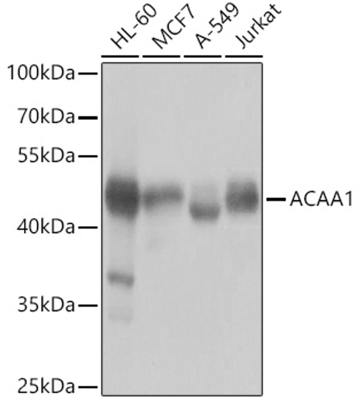 Western blot analysis of extracts of various cell lines, using ACAA1 antibody (22-925) at 1:1000 dilution.<br/>Secondary antibody: HRP Goat Anti-Rabbit IgG (H+L) at 1:10000 dilution.<br/>Lysates/proteins: 25ug per lane.<br/>Blocking buffer: 3% nonfat dry milk in TBST.<br/>Detection: ECL Basic Kit.<br/>Exposure time: 1s.