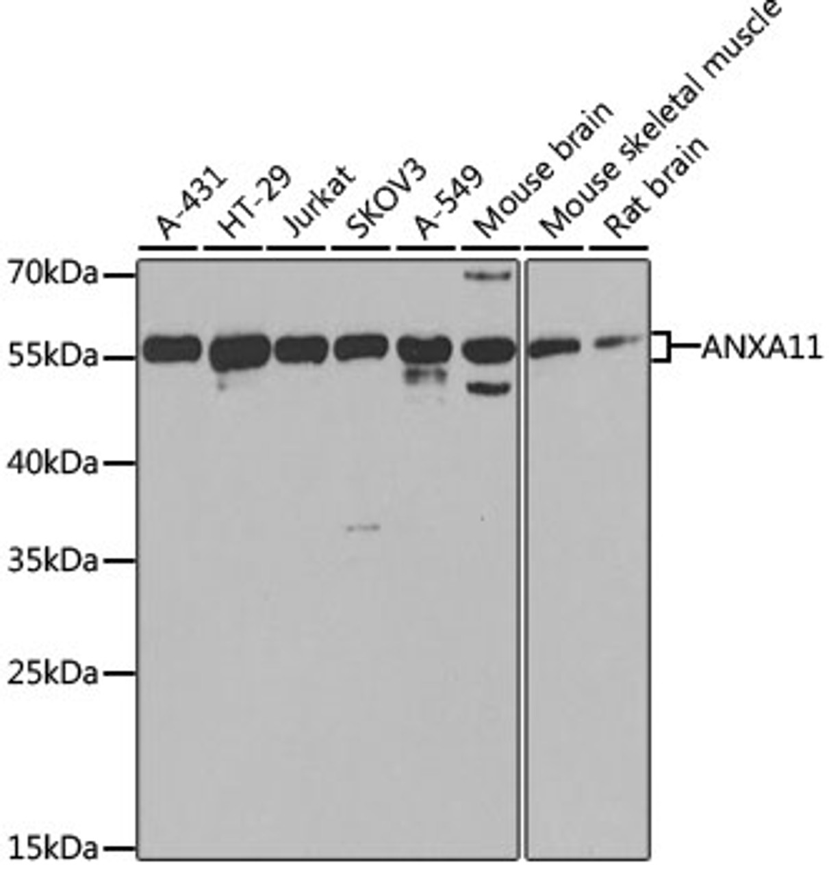 Western blot analysis of extracts of various cell lines, using ANXA11 antibody (22-926) at 1:1000 dilution.<br/>Secondary antibody: HRP Goat Anti-Rabbit IgG (H+L) at 1:10000 dilution.<br/>Lysates/proteins: 25ug per lane.<br/>Blocking buffer: 3% nonfat dry milk in TBST.<br/>Detection: ECL Basic Kit.<br/>Exposure time: 30s.