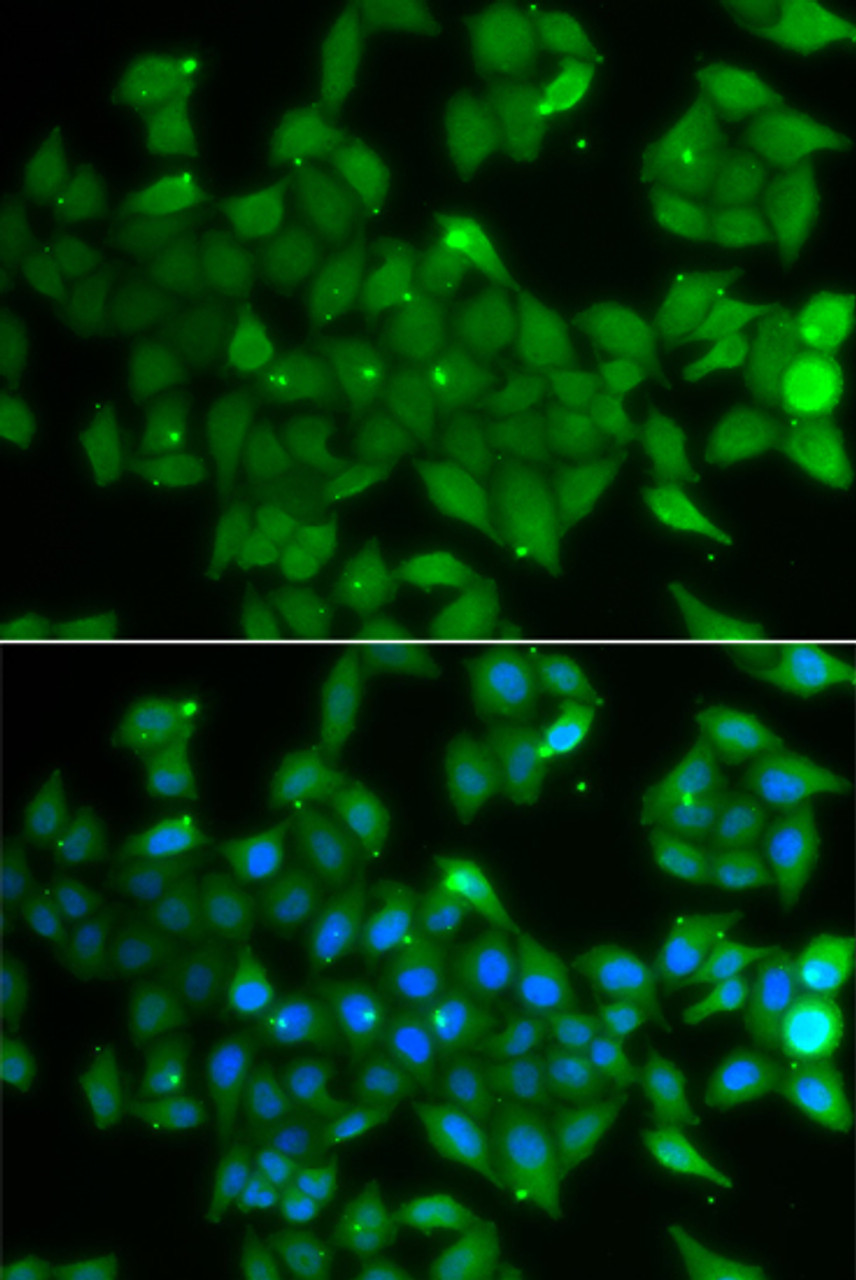 Immunofluorescence analysis of A549 cells using ANXA11 antibody (22-926) . Blue: DAPI for nuclear staining.