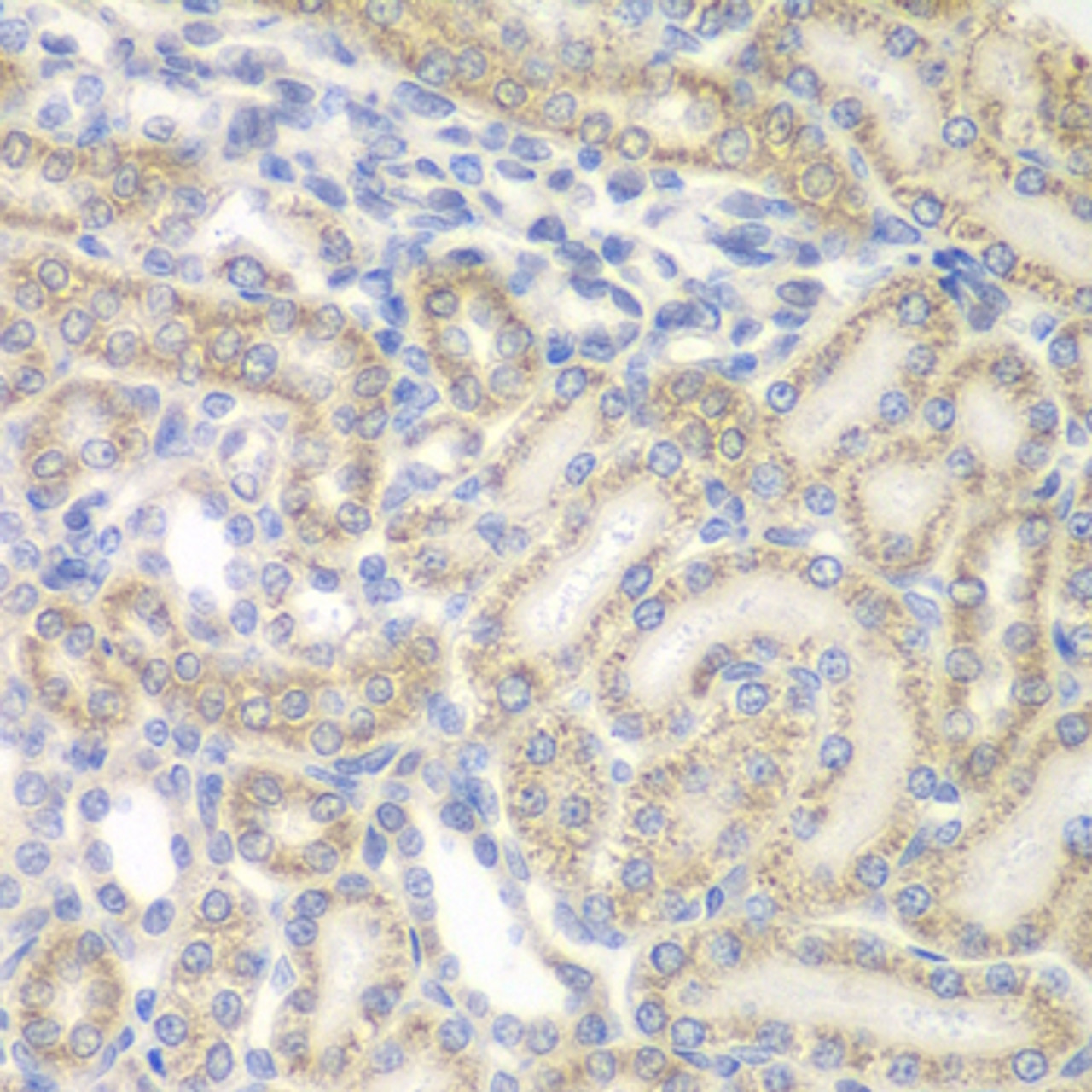 Immunohistochemistry of paraffin-embedded rat kidney using AUH antibody (22-927) at dilution of 1:100 (40x lens) .