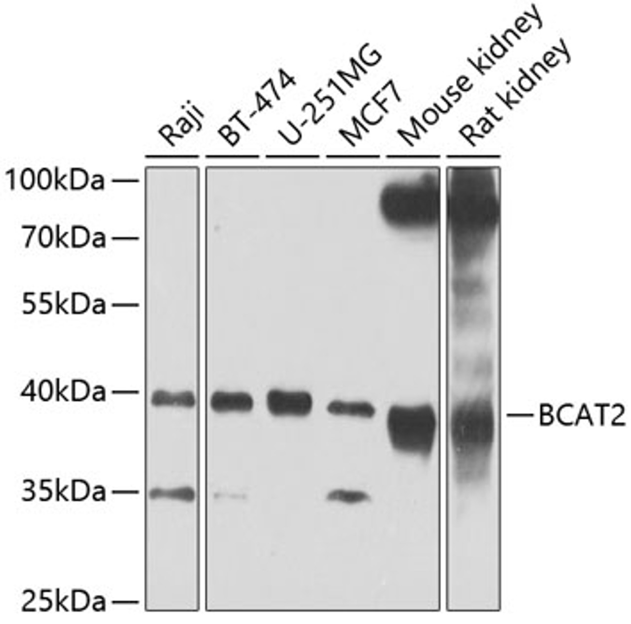 Western blot analysis of extracts of various cell lines, using BCAT2 Antibody (22-929) at 1:1000 dilution._Secondary antibody: HRP Goat Anti-Rabbit IgG (H+L) at 1:10000 dilution._Lysates/proteins: 25ug per lane._Blocking buffer: 3% nonfat dry milk in TBST._Detection: ECL Enhanced Kit._Exposure time: 60s.