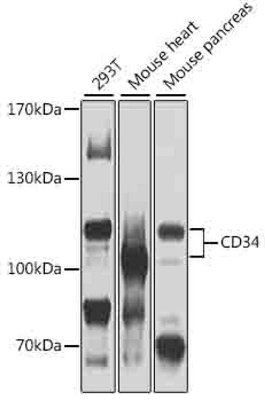 Western blot analysis of extracts of various cell lines, using CD34 antibody (22-932) at 1:1000 dilution.<br/>Secondary antibody: HRP Goat Anti-Rabbit IgG (H+L) at 1:10000 dilution.<br/>Lysates/proteins: 25ug per lane.<br/>Blocking buffer: 3% nonfat dry milk in TBST.<br/>Detection: ECL Basic Kit.<br/>Exposure time: 30s.