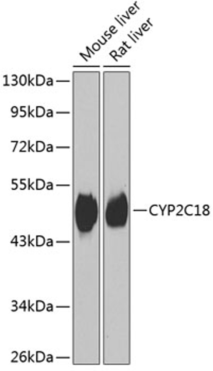 Western blot analysis of extracts of various cell lines, using CYP2C18 antibody (22-934) at 1:1000 dilution.<br/>Secondary antibody: HRP Goat Anti-Rabbit IgG (H+L) at 1:10000 dilution.<br/>Lysates/proteins: 25ug per lane.<br/>Blocking buffer: 3% nonfat dry milk in TBST.<br/>Detection: ECL Basic Kit.<br/>Exposure time: 90s.