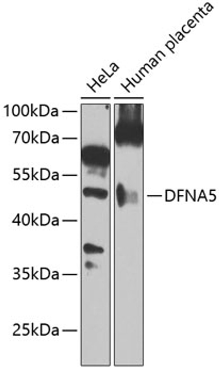 Western blot analysis of extracts of various cell lines, using DFNA5 Antibody (22-935) at 1:1000 dilution._Secondary antibody: HRP Goat Anti-Rabbit IgG (H+L) at 1:10000 dilution._Lysates/proteins: 25ug per lane._Blocking buffer: 3% nonfat dry milk in TBST._Detection: ECL Enhanced Kit._Exposure time: 60s.