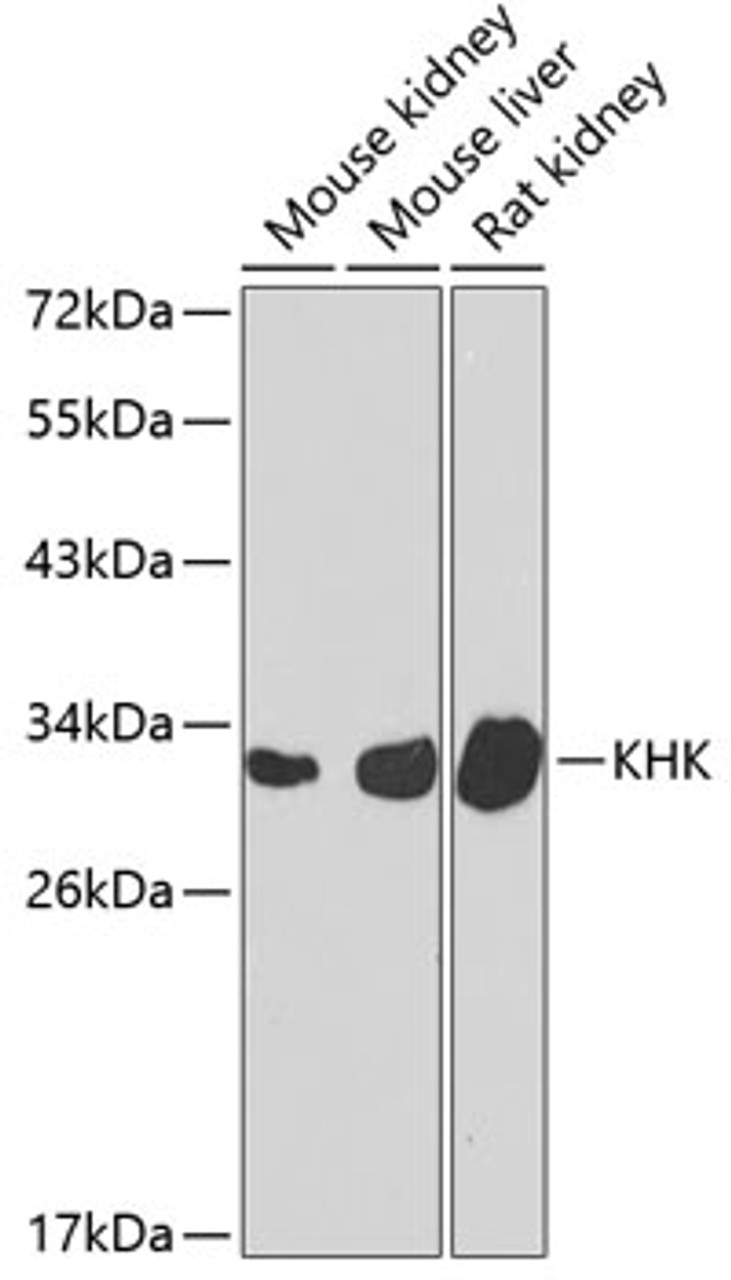 Western blot analysis of extracts of various cell lines, using KHK antibody (22-940) at 1:1000 dilution.<br/>Secondary antibody: HRP Goat Anti-Rabbit IgG (H+L) at 1:10000 dilution.<br/>Lysates/proteins: 25ug per lane.<br/>Blocking buffer: 3% nonfat dry milk in TBST.<br/>Detection: ECL Basic Kit.<br/>Exposure time: 90s.