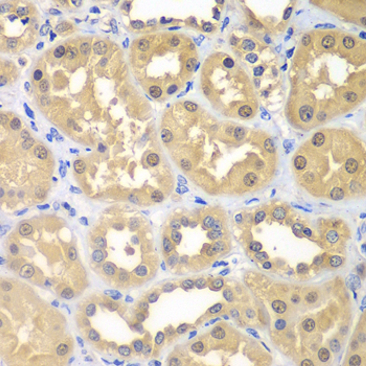 Immunohistochemistry of paraffin-embedded human kidney using KHK antibody (22-940) at dilution of 1:100 (40x lens) .