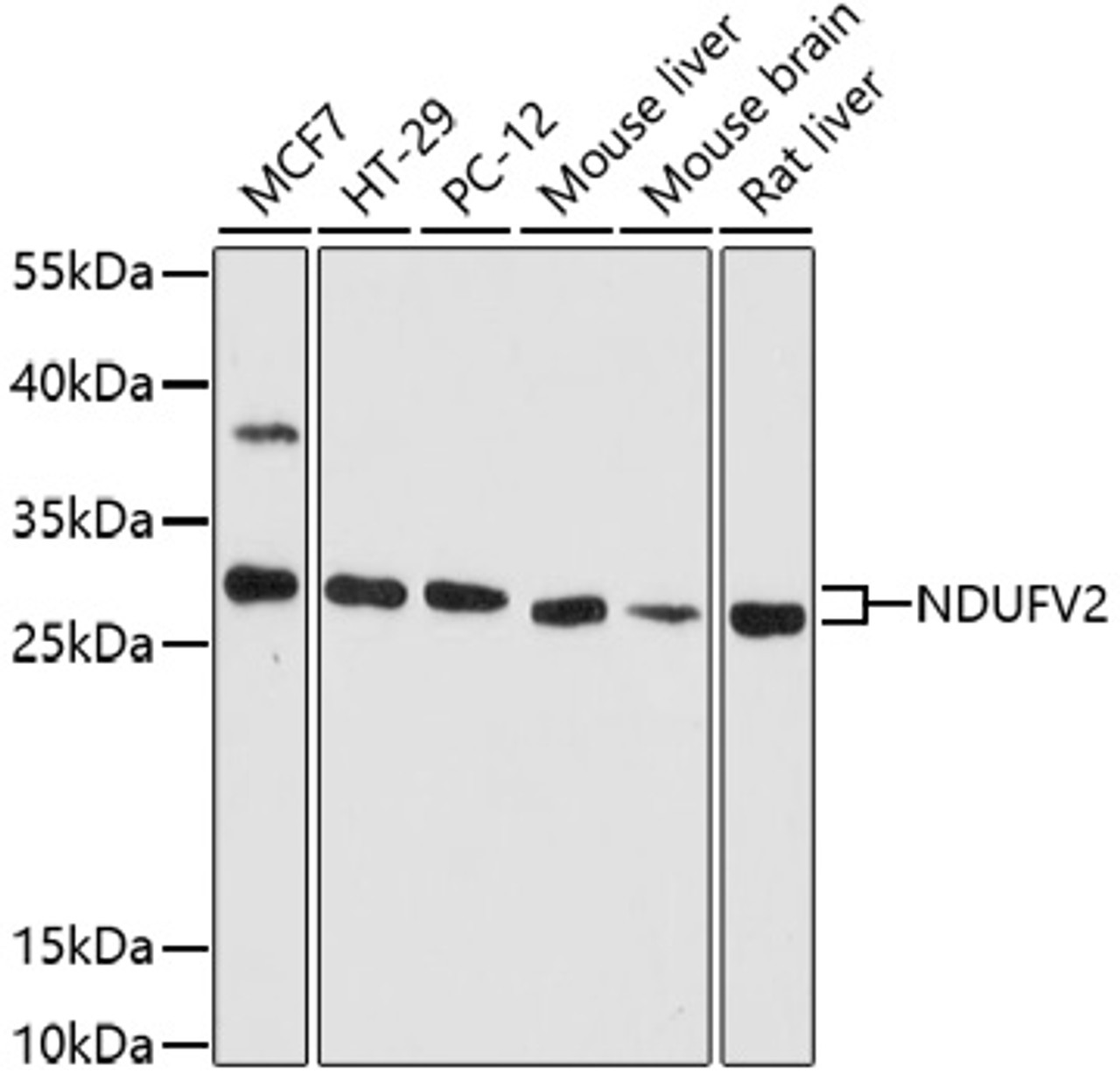 Immunohistochemistry of paraffin-embedded rat kidney using NDUFV2 antibody (22-942) at dilution of 1:100 (40x lens) .