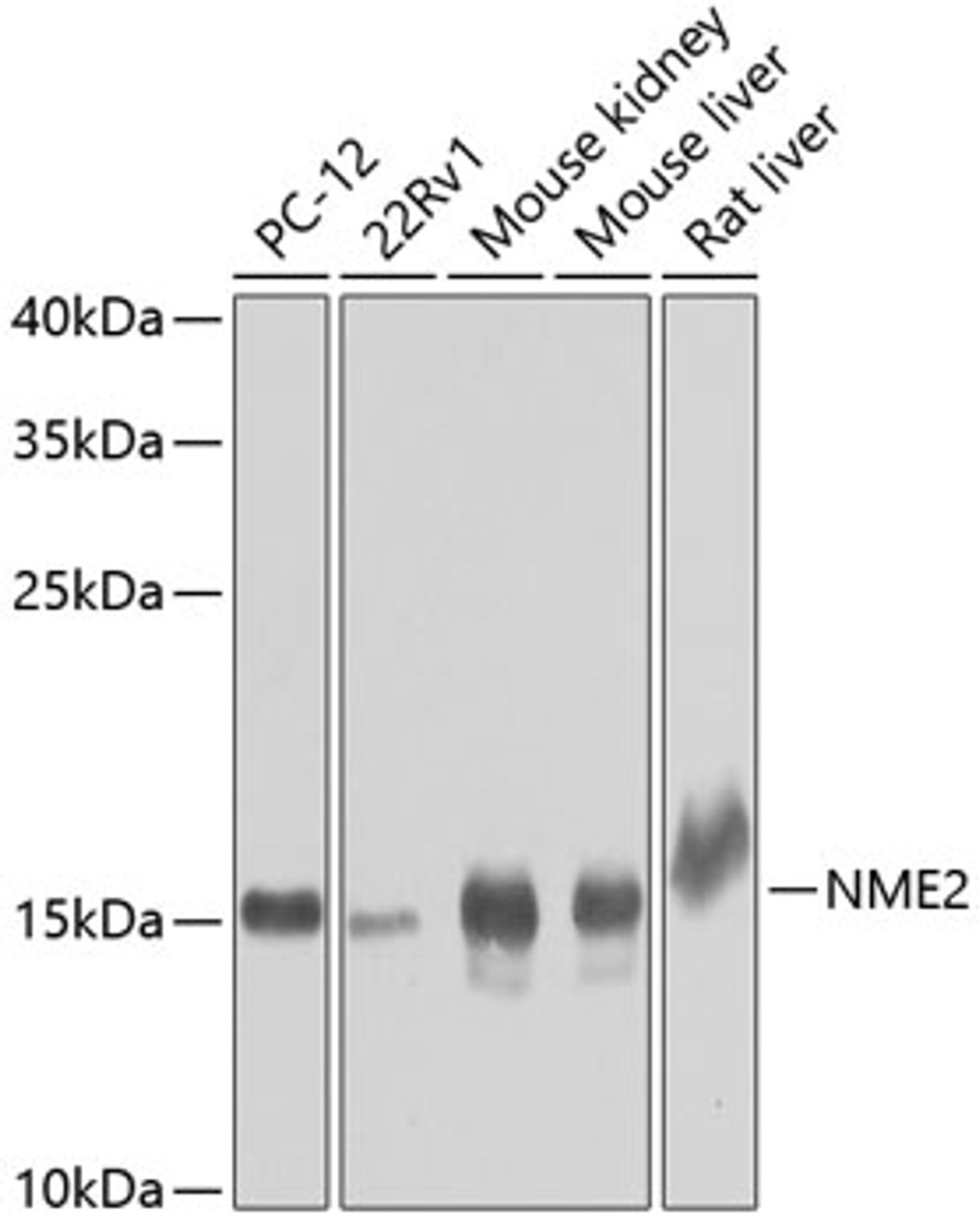 Western blot analysis of extracts of various cell lines, using NME2 antibody (22-943) at 1:1000 dilution.<br/>Secondary antibody: HRP Goat Anti-Rabbit IgG (H+L) at 1:10000 dilution.<br/>Lysates/proteins: 25ug per lane.<br/>Blocking buffer: 3% nonfat dry milk in TBST.<br/>Detection: ECL Basic Kit.<br/>Exposure time: 30s.