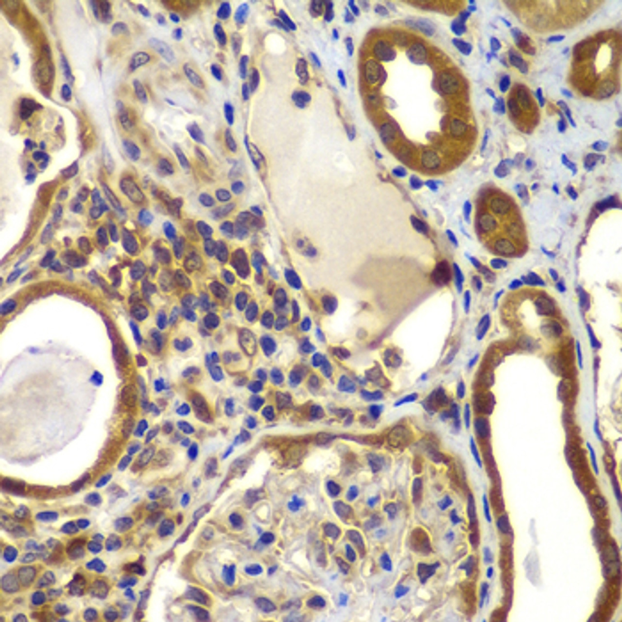 Immunohistochemistry of paraffin-embedded human kidney using NME2 antibody (22-943) at dilution of 1:100 (40x lens) .