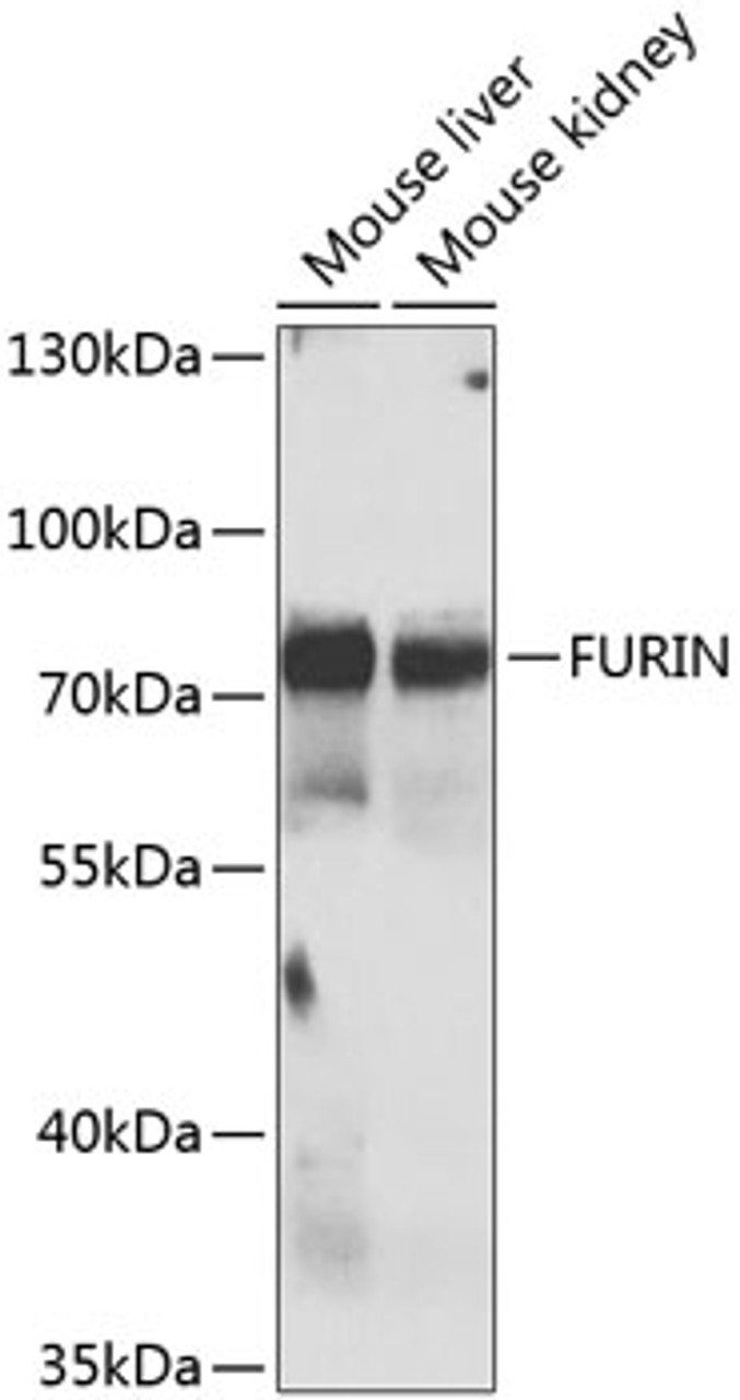 Western blot analysis of extracts of various cell lines, using FURIN antibody (22-945) at 1:1000 dilution._Secondary antibody: HRP Goat Anti-Rabbit IgG (H+L) at 1:10000 dilution._Lysates/proteins: 25ug per lane._Blocking buffer: 3% nonfat dry milk in TBST._Detection: ECL Enhanced Kit._Exposure time: 5s.