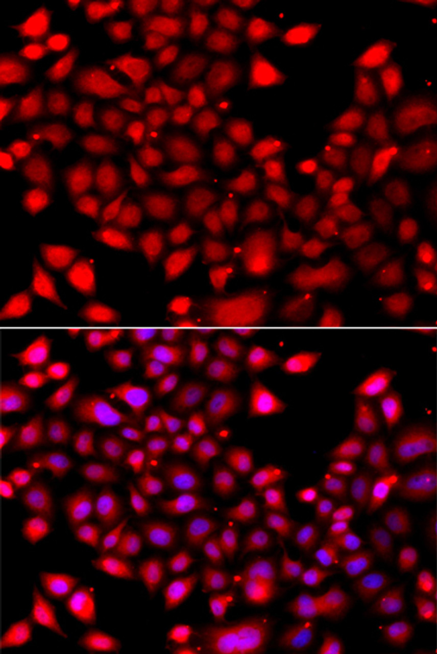 Immunofluorescence analysis of A549 cells using RARG antibody (22-948) . Blue: DAPI for nuclear staining.