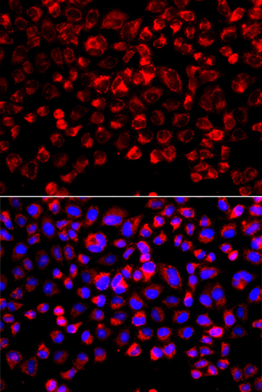Immunofluorescence analysis of A549 cells using SULT1E1 antibody (22-950) . Blue: DAPI for nuclear staining.