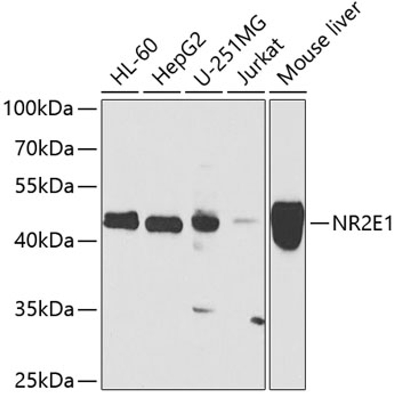 Western blot analysis of extracts of various cell lines, using NR2E1 antibody (22-952) at 1:1000 dilution.<br/>Secondary antibody: HRP Goat Anti-Rabbit IgG (H+L) at 1:10000 dilution.<br/>Lysates/proteins: 25ug per lane.<br/>Blocking buffer: 3% nonfat dry milk in TBST.<br/>Detection: ECL Basic Kit.<br/>Exposure time: 90s.
