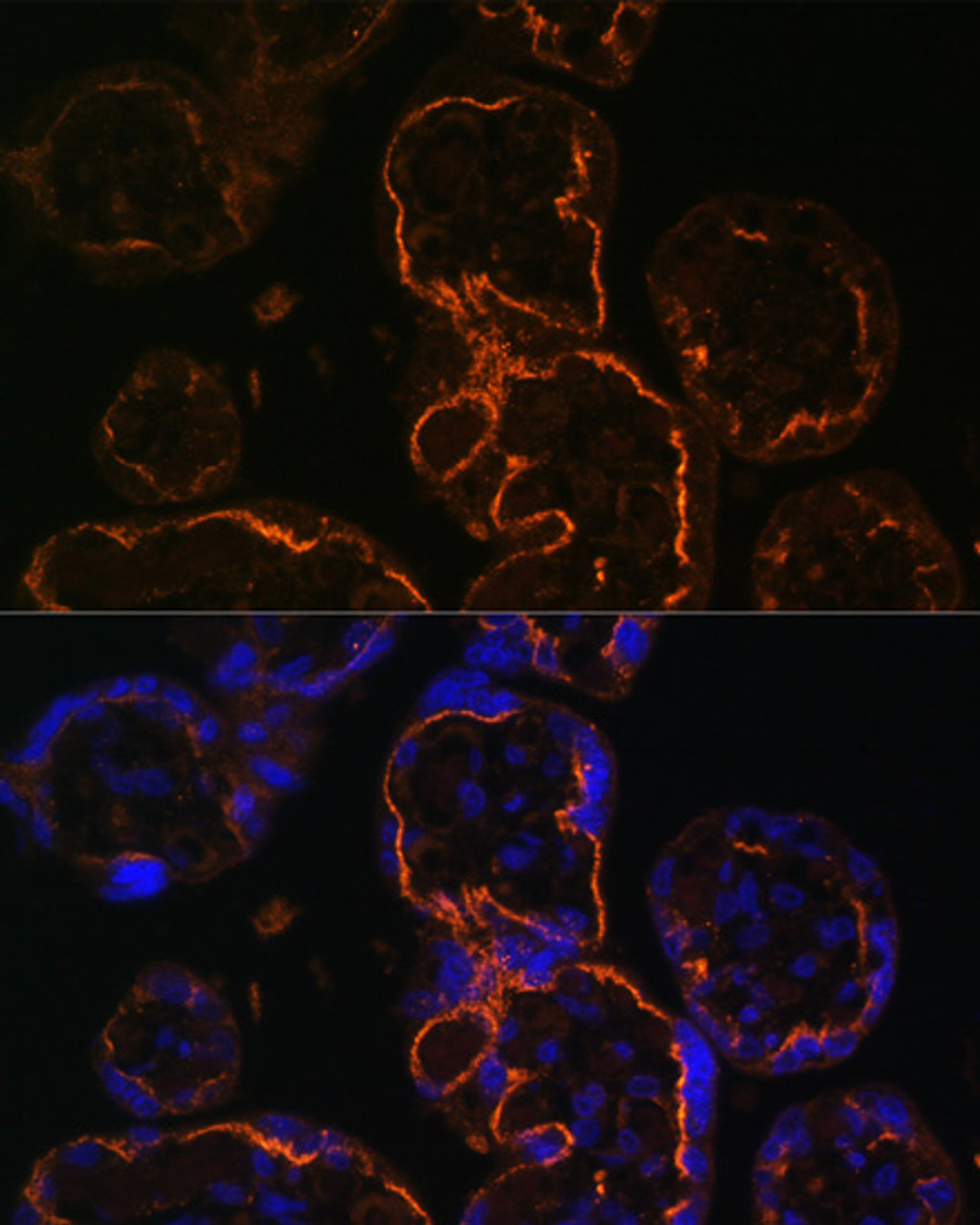 Immunofluorescence analysis of human placenta cells using LDB3 antibody (22-958) at dilution of 1:100. Blue: DAPI for nuclear staining.